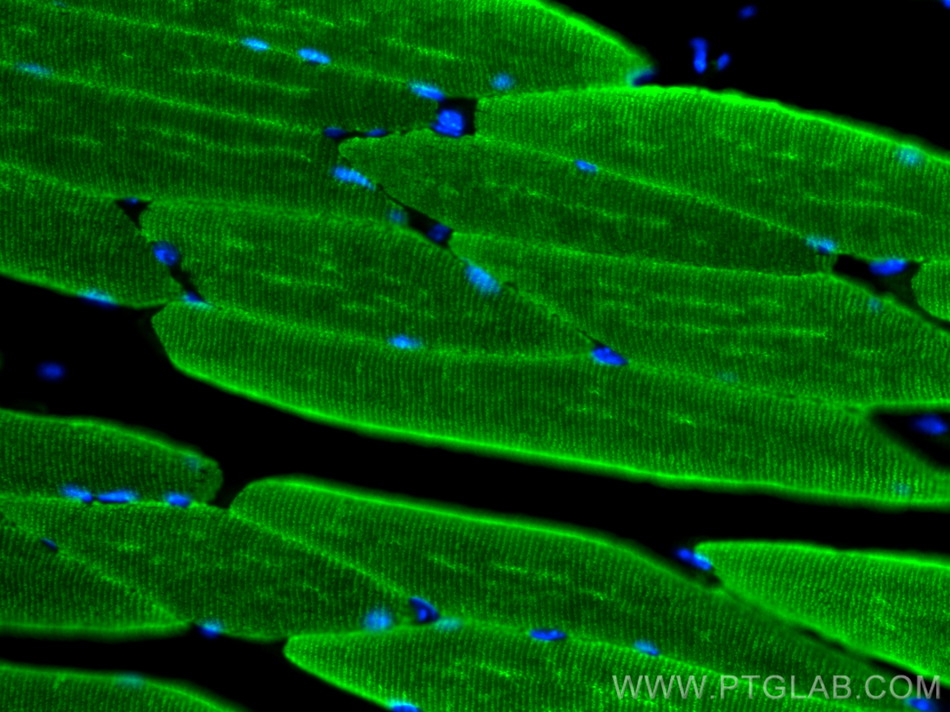 Immunofluorescence (IF) / fluorescent staining of mouse skeletal muscle tissue using Alpha Actin Polyclonal antibody (23660-1-AP)