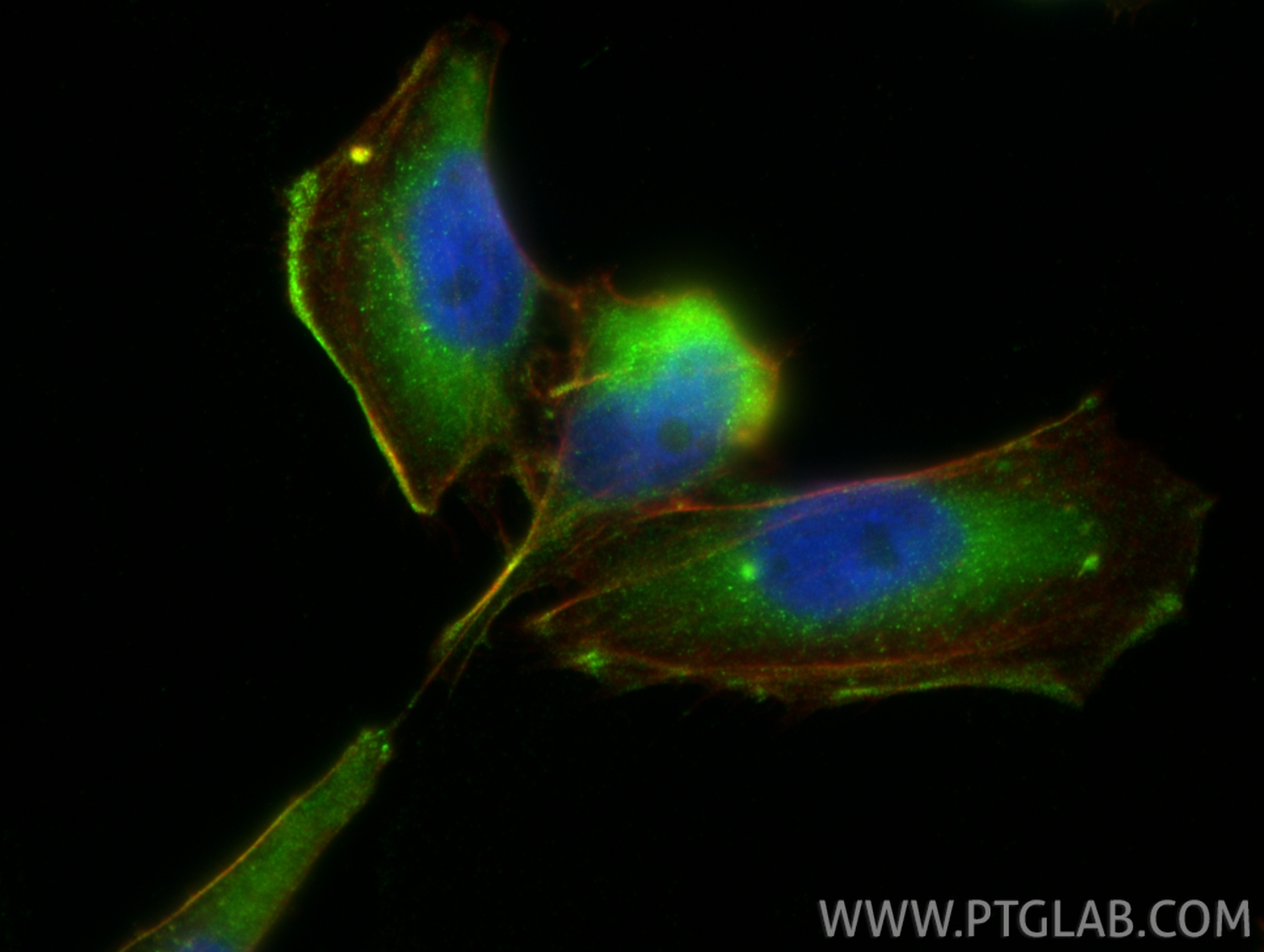Immunofluorescence (IF) / fluorescent staining of AC16 cells using Alpha Actin Polyclonal antibody (23660-1-AP)