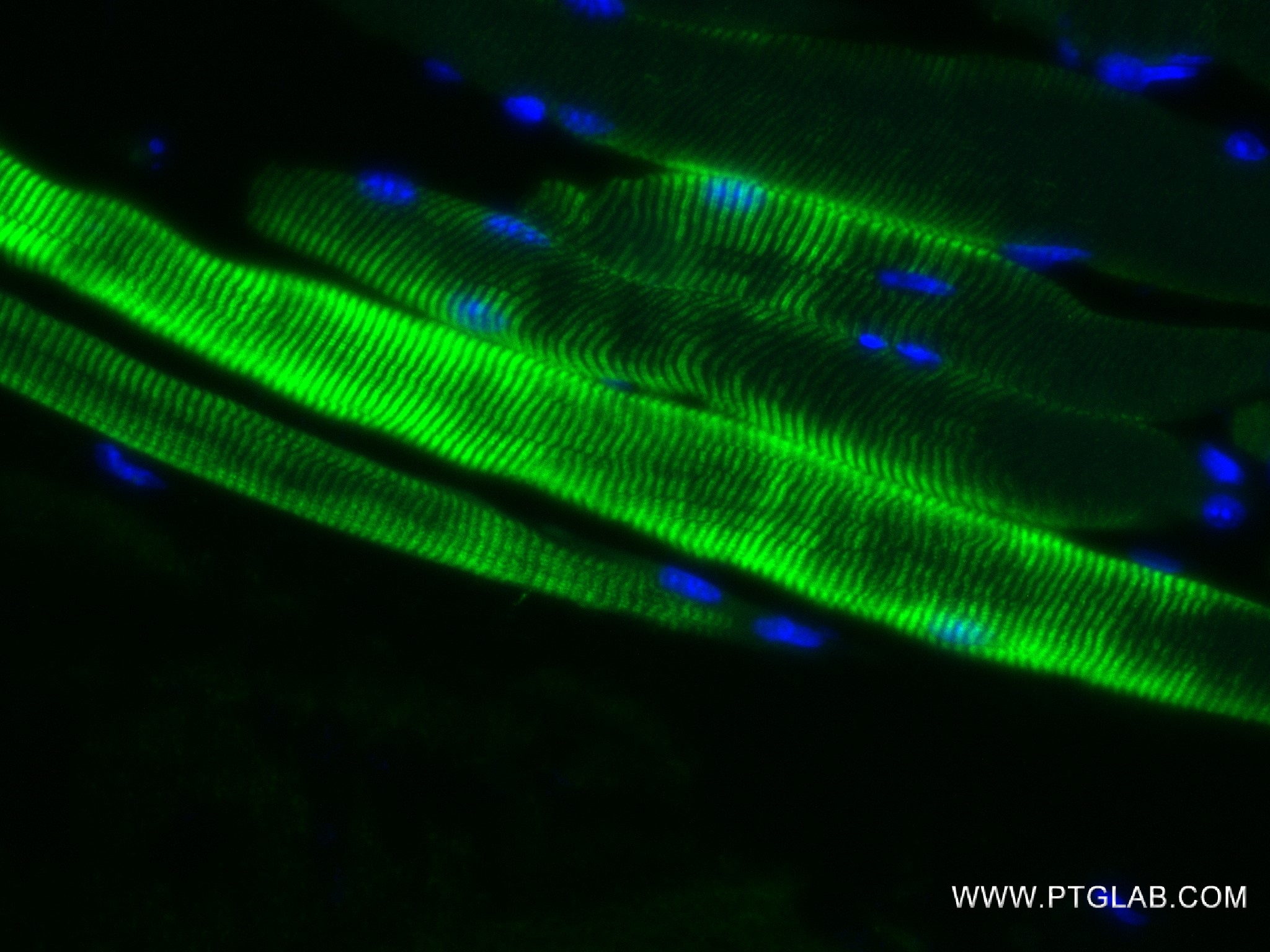 Immunofluorescence (IF) / fluorescent staining of mouse skeletal muscle tissue using ACTA1-Specific Recombinant antibody (82714-5-RR)