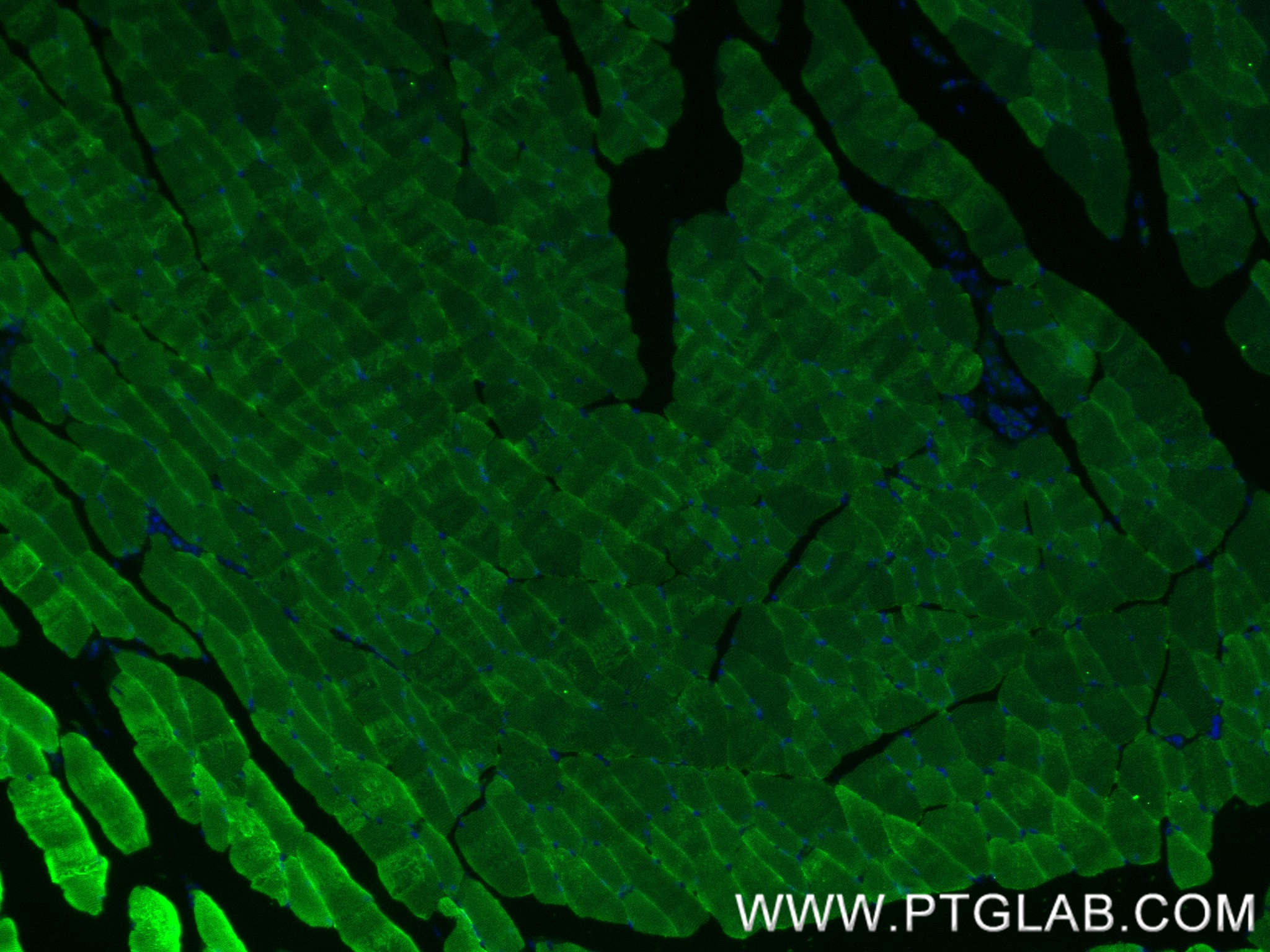 Immunofluorescence (IF) / fluorescent staining of mouse skeletal muscle tissue using ACTA1-Specific Recombinant antibody (82714-5-RR)