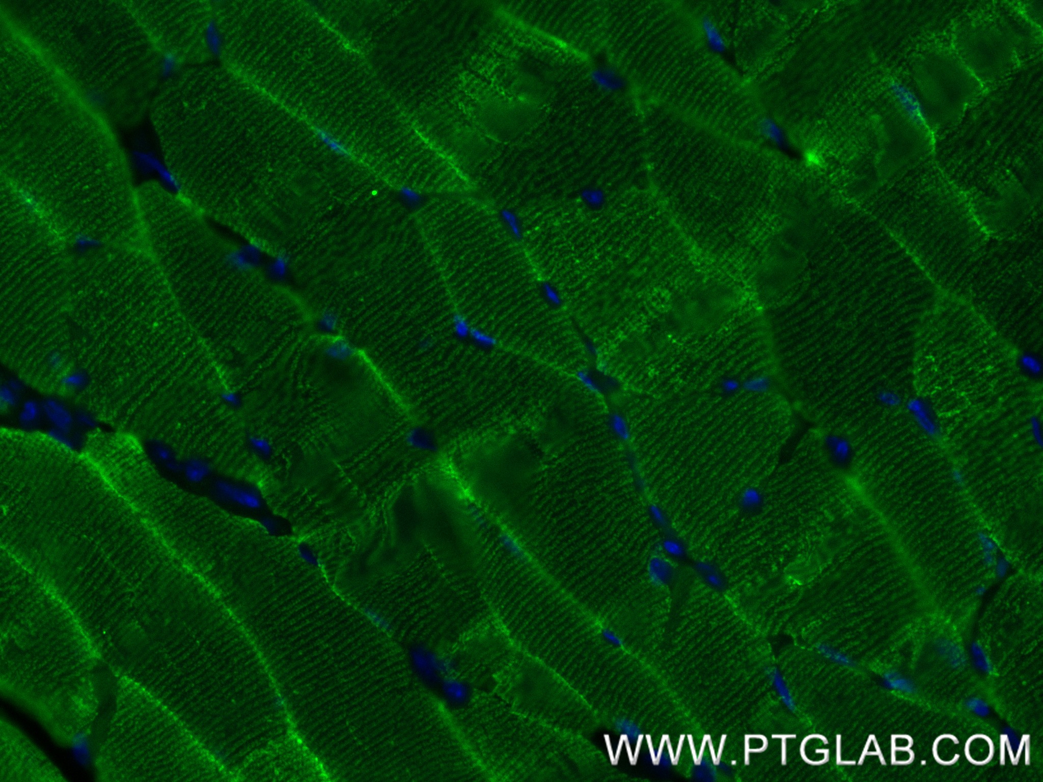 Immunofluorescence (IF) / fluorescent staining of mouse skeletal muscle tissue using ACTA1-Specific Recombinant antibody (82714-5-RR)