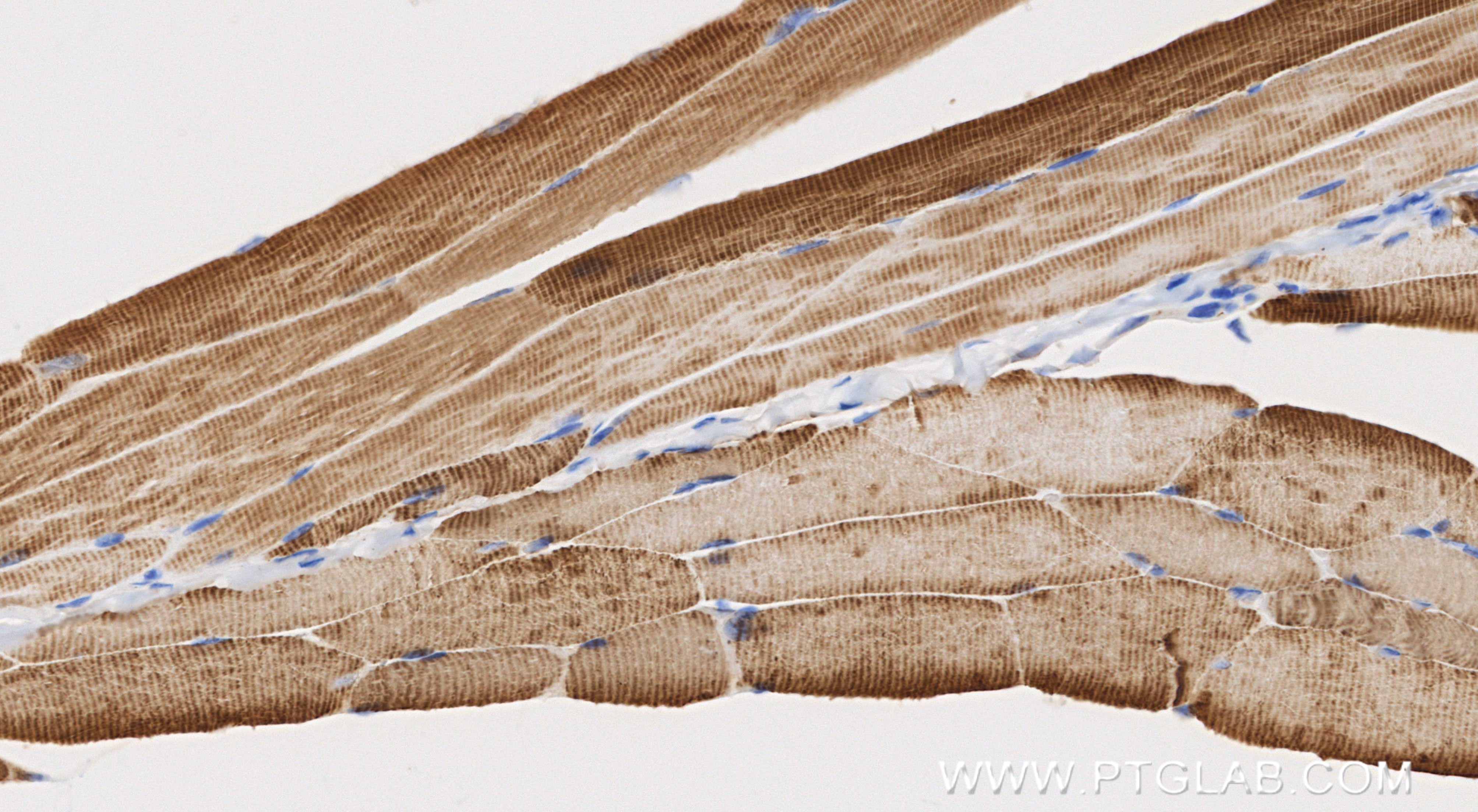 Immunohistochemistry (IHC) staining of mouse skeletal muscle tissue using ACTA1-Specific Recombinant monoclonal antibody (82714-5-RR)