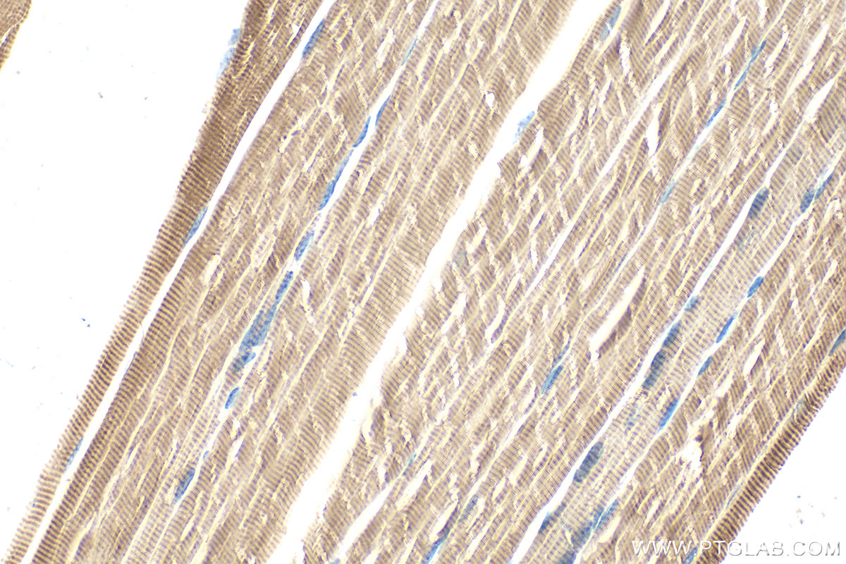 Immunohistochemistry (IHC) staining of mouse skeletal muscle tissue using ACTA1-Specific Polyclonal antibody (17521-1-AP)