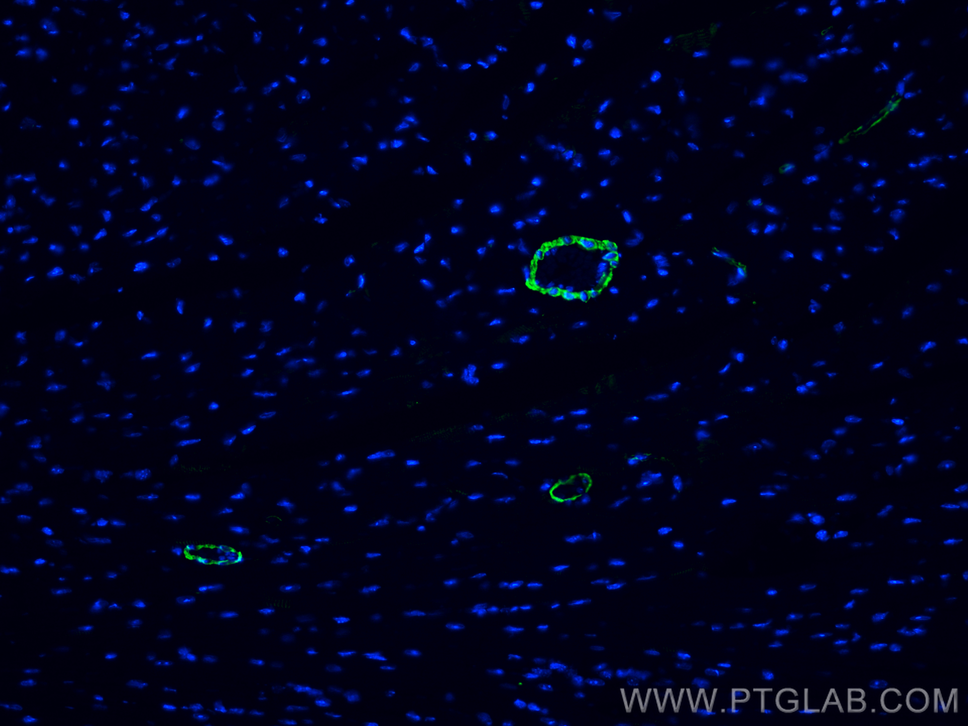 Immunofluorescence (IF) / fluorescent staining of mouse heart tissue using Alpha smooth muscle actin Polyclonal antibody (14395-1-AP)