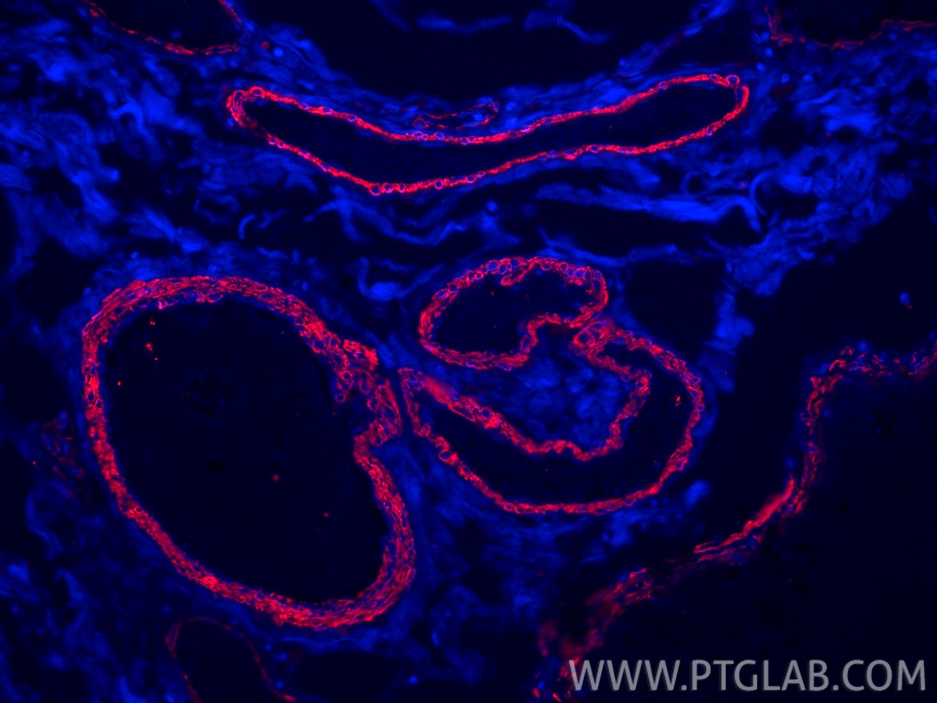 Immunofluorescence (IF) / fluorescent staining of human colon tissue using Alpha smooth muscle actin Polyclonal antibody (14395-1-AP)