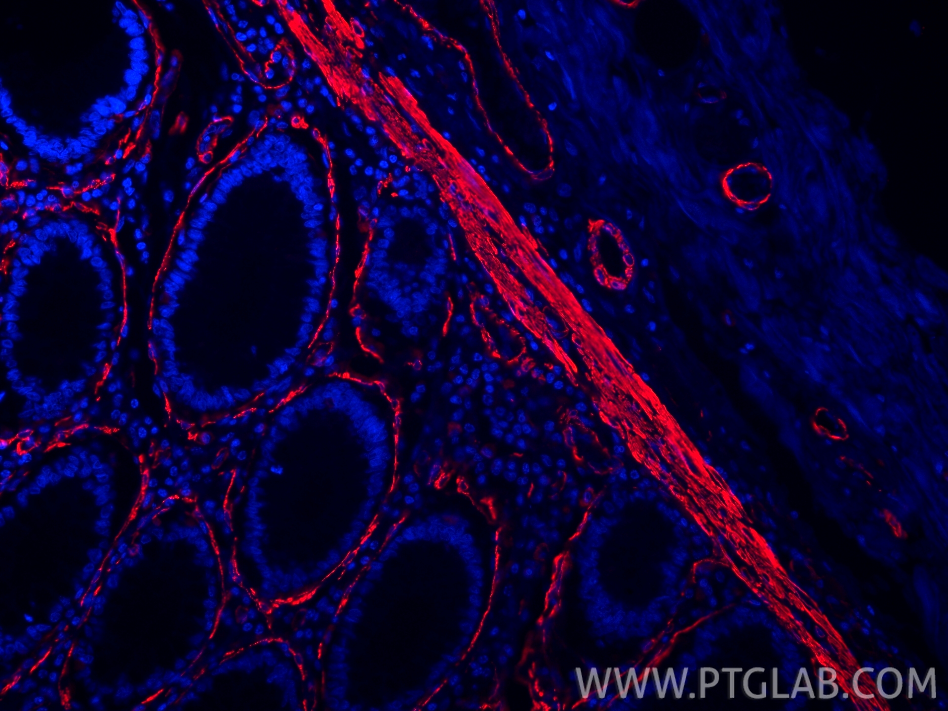 Immunofluorescence (IF) / fluorescent staining of human colon tissue using Alpha smooth muscle actin Polyclonal antibody (14395-1-AP)