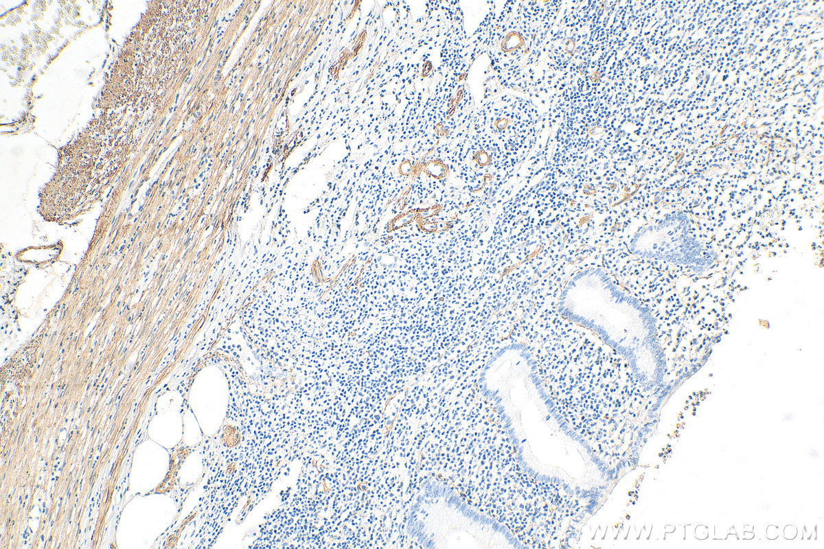 Immunohistochemistry (IHC) staining of human appendicitis tissue using Alpha smooth muscle actin Polyclonal antibody (14395-1-AP)