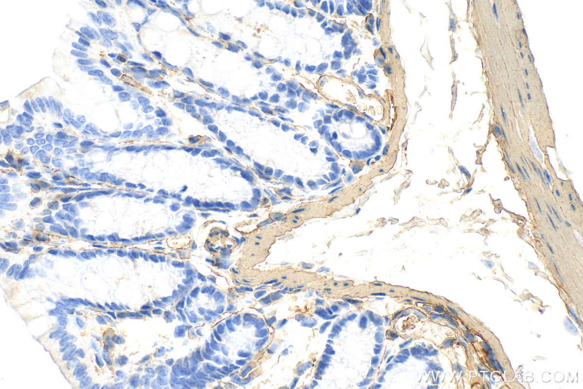 Immunohistochemistry (IHC) staining of mouse colon tissue using Alpha smooth muscle actin Polyclonal antibody (14395-1-AP)