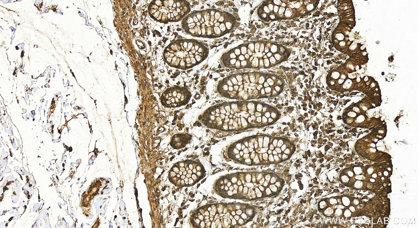 Immunohistochemistry (IHC) staining of human colon tissue using Beta Actin Polyclonal antibody (20536-1-AP)