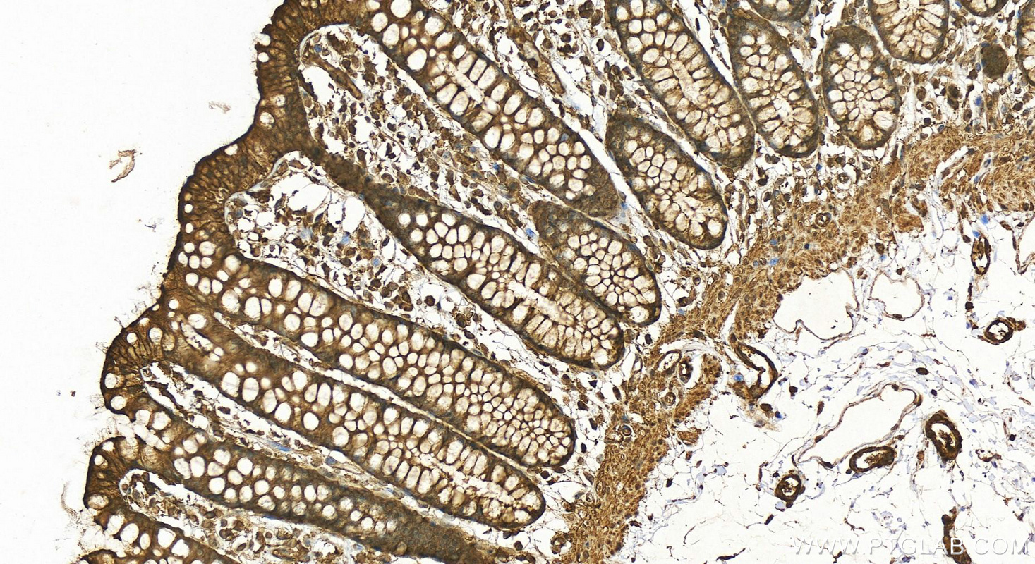 Immunohistochemistry (IHC) staining of human colon tissue using Beta Actin Polyclonal antibody (20536-1-AP)