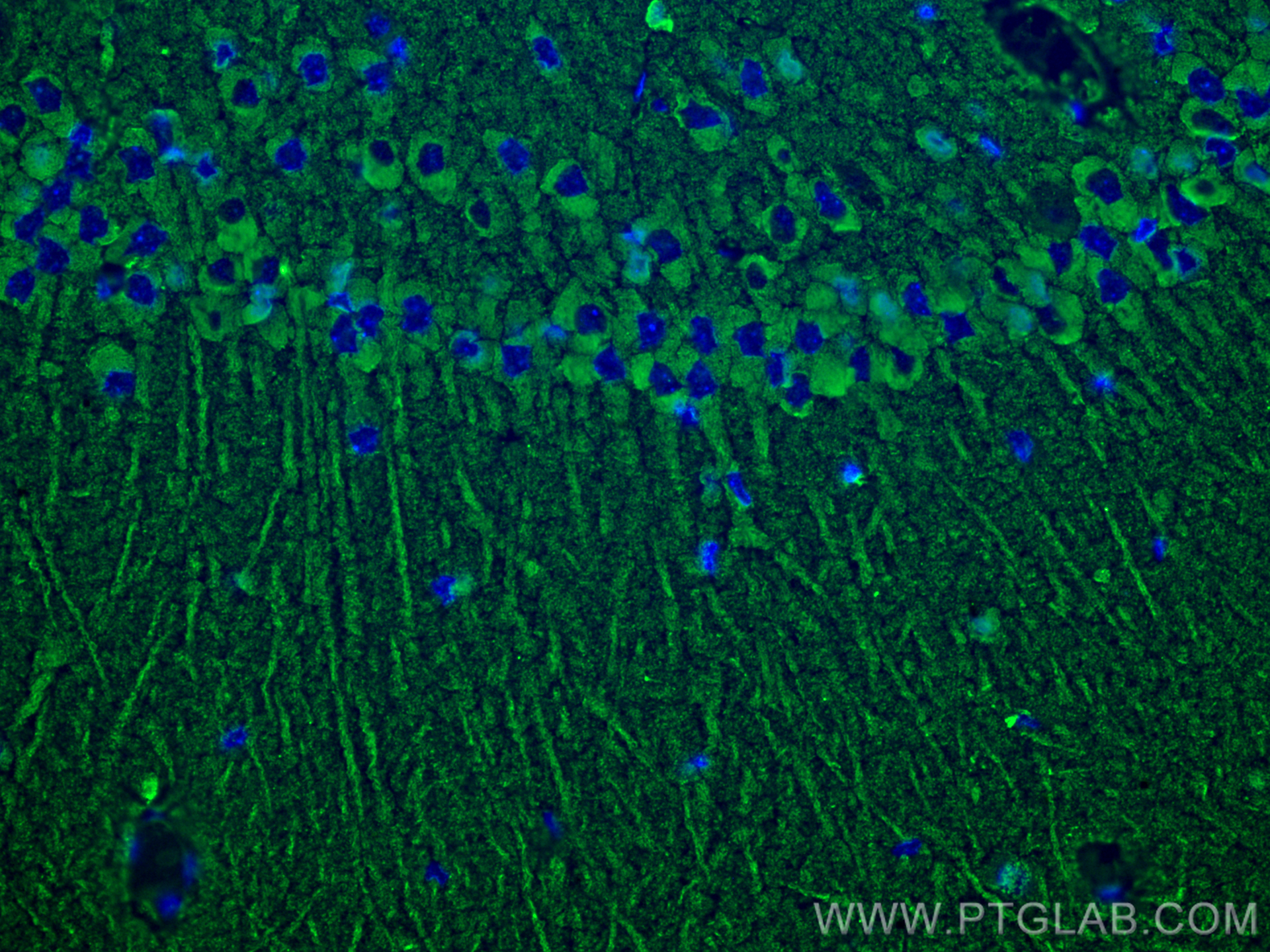 Immunofluorescence (IF) / fluorescent staining of rat brain tissue using Beta Actin Monoclonal antibody (60008-1-Ig)