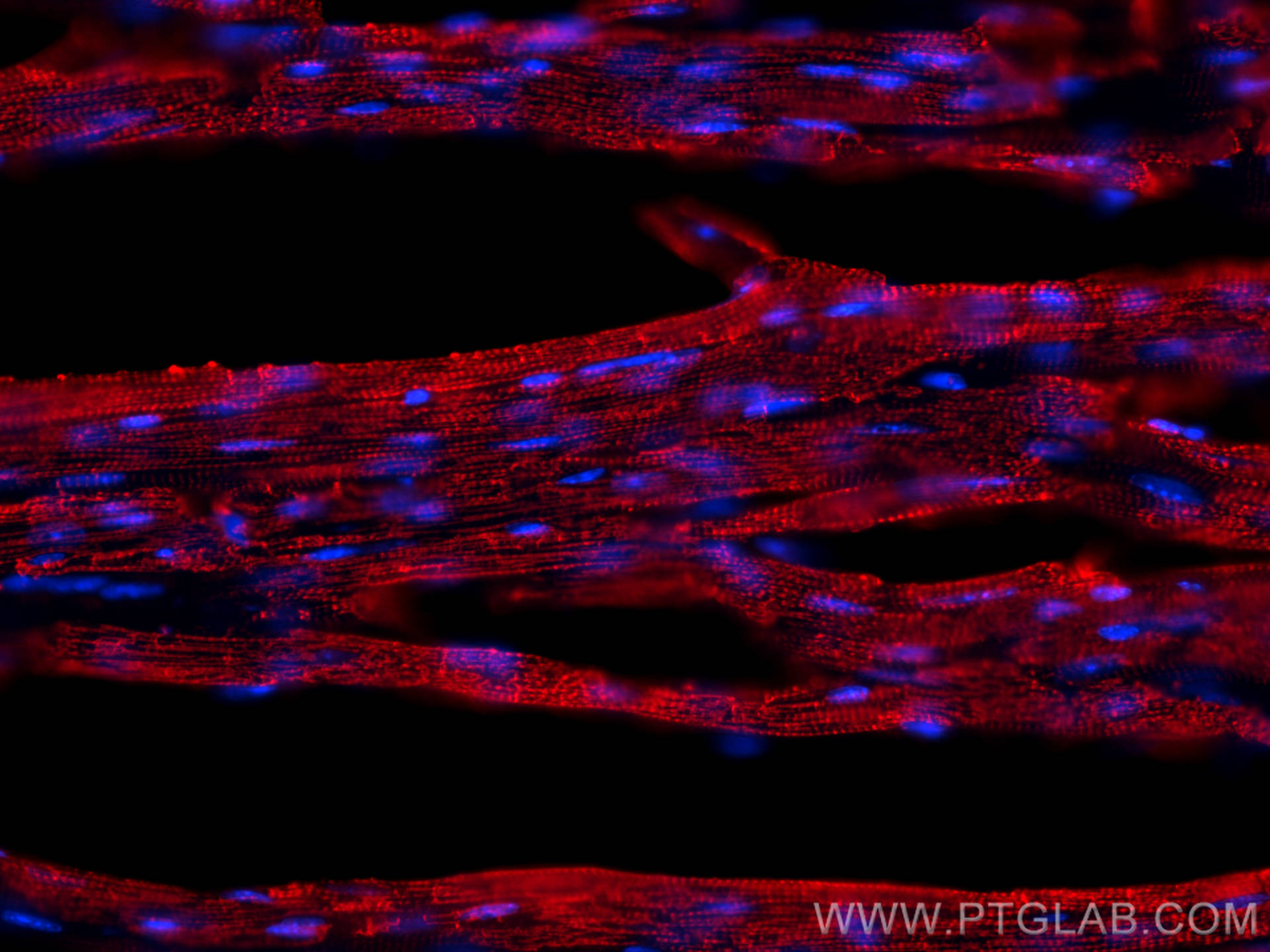 Immunofluorescence (IF) / fluorescent staining of mouse heart tissue using ACTC1-specific Monoclonal antibody (66125-1-Ig)