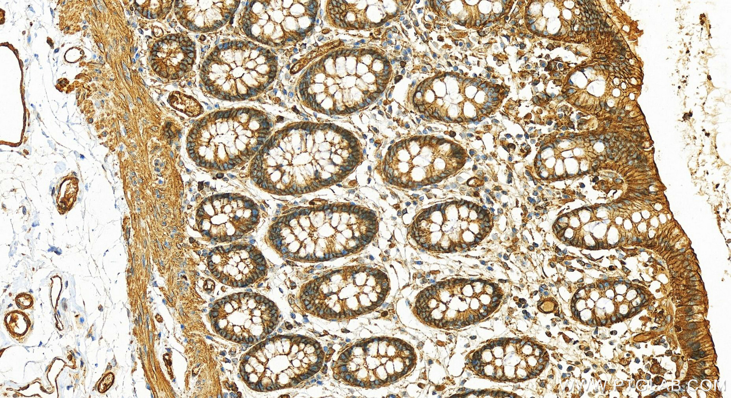 Immunohistochemistry (IHC) staining of human colon tissue using Alpha Actinin Polyclonal antibody (11313-2-AP)