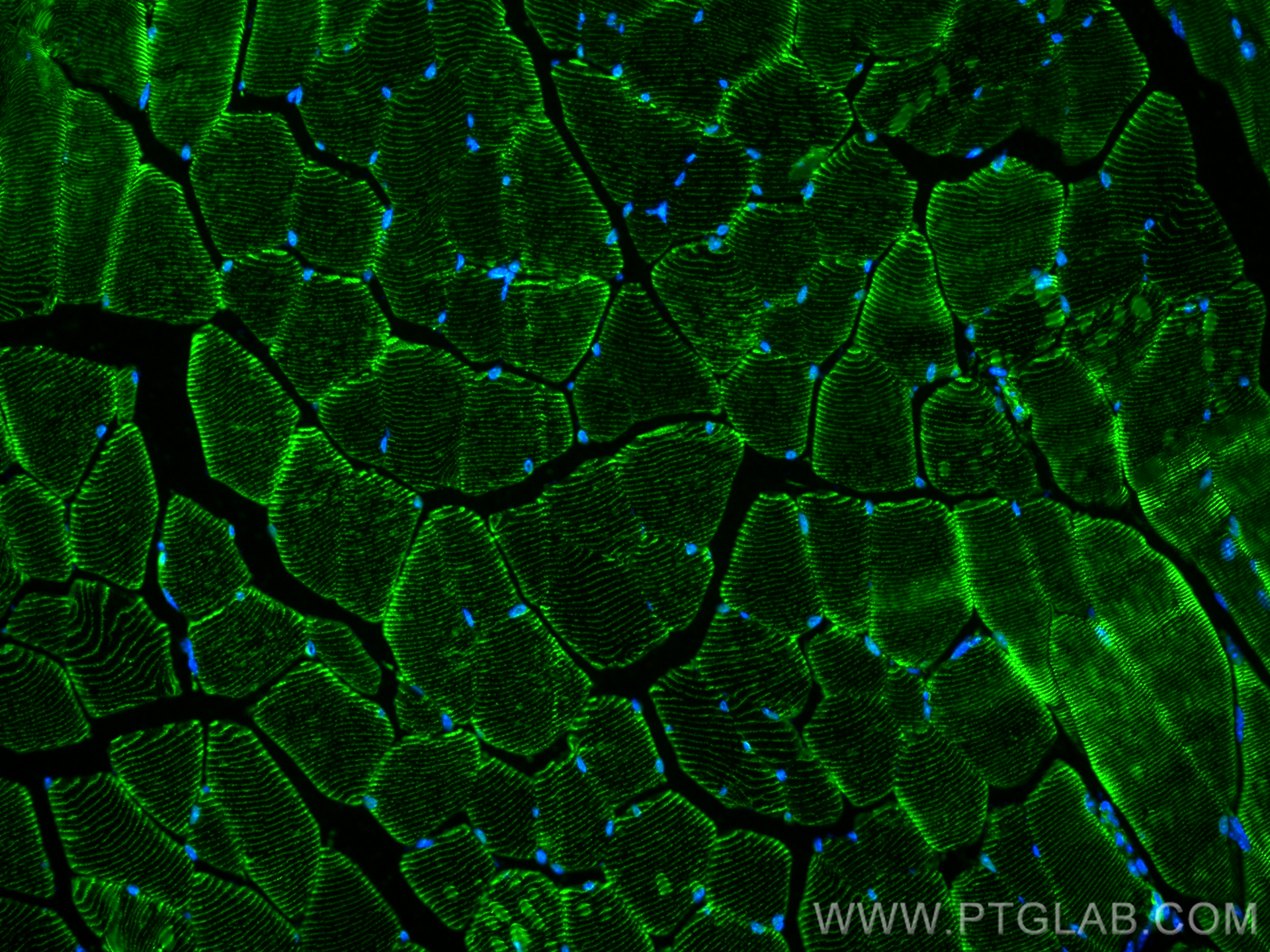 Immunofluorescence (IF) / fluorescent staining of mouse skeletal muscle tissue using Alpha Actinin Polyclonal antibody (11313-2-AP)