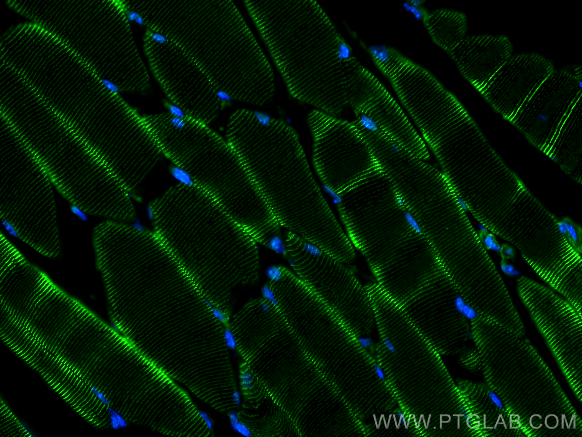 Immunofluorescence (IF) / fluorescent staining of mouse skeletal muscle tissue using Alpha Actinin Polyclonal antibody (11313-2-AP)