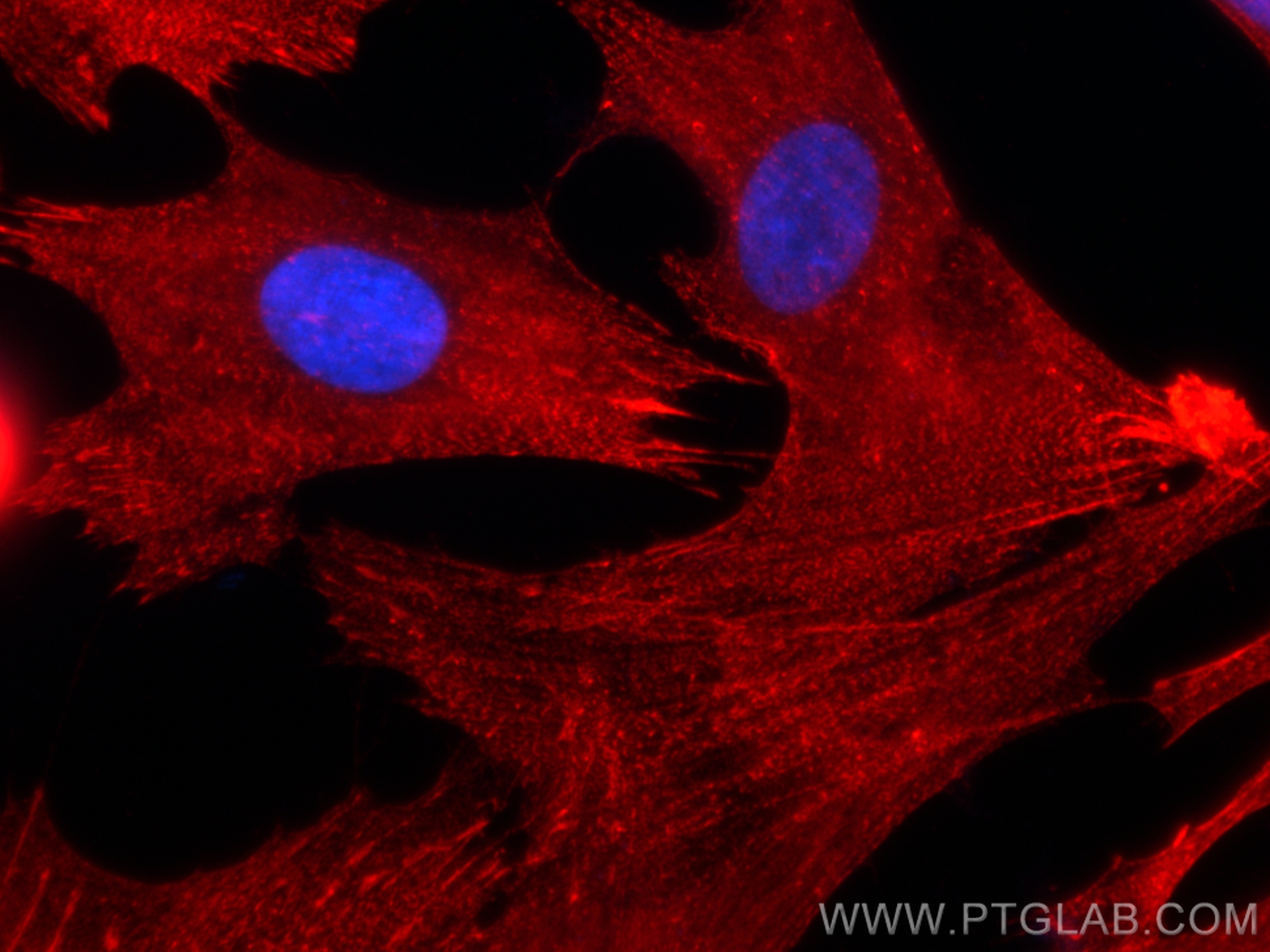 Immunofluorescence (IF) / fluorescent staining of HSkMC cells using Alpha Actinin Polyclonal antibody (11313-2-AP)