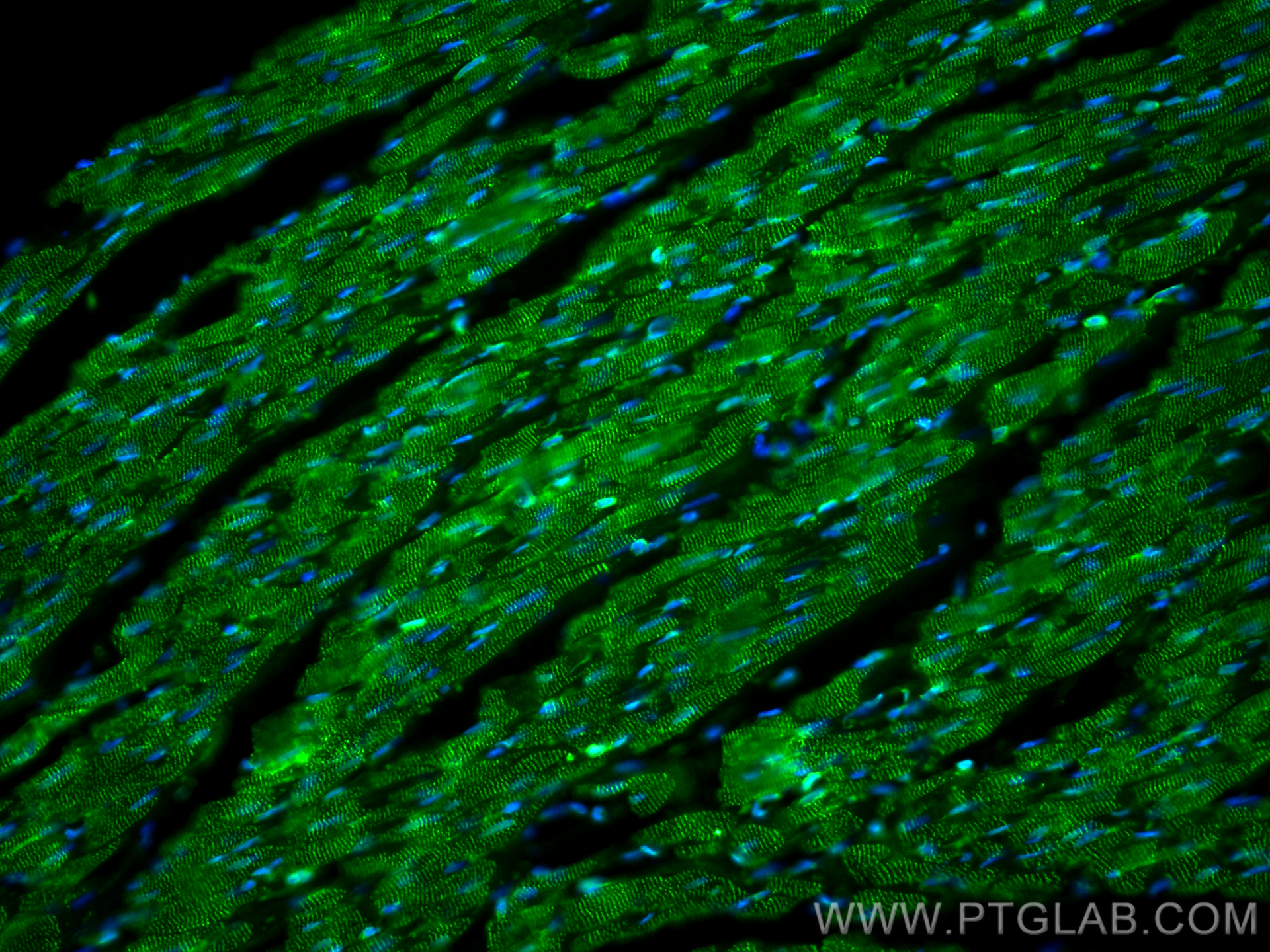 Immunofluorescence (IF) / fluorescent staining of rat heart tissue using Alpha Actinin Polyclonal antibody (11313-2-AP)