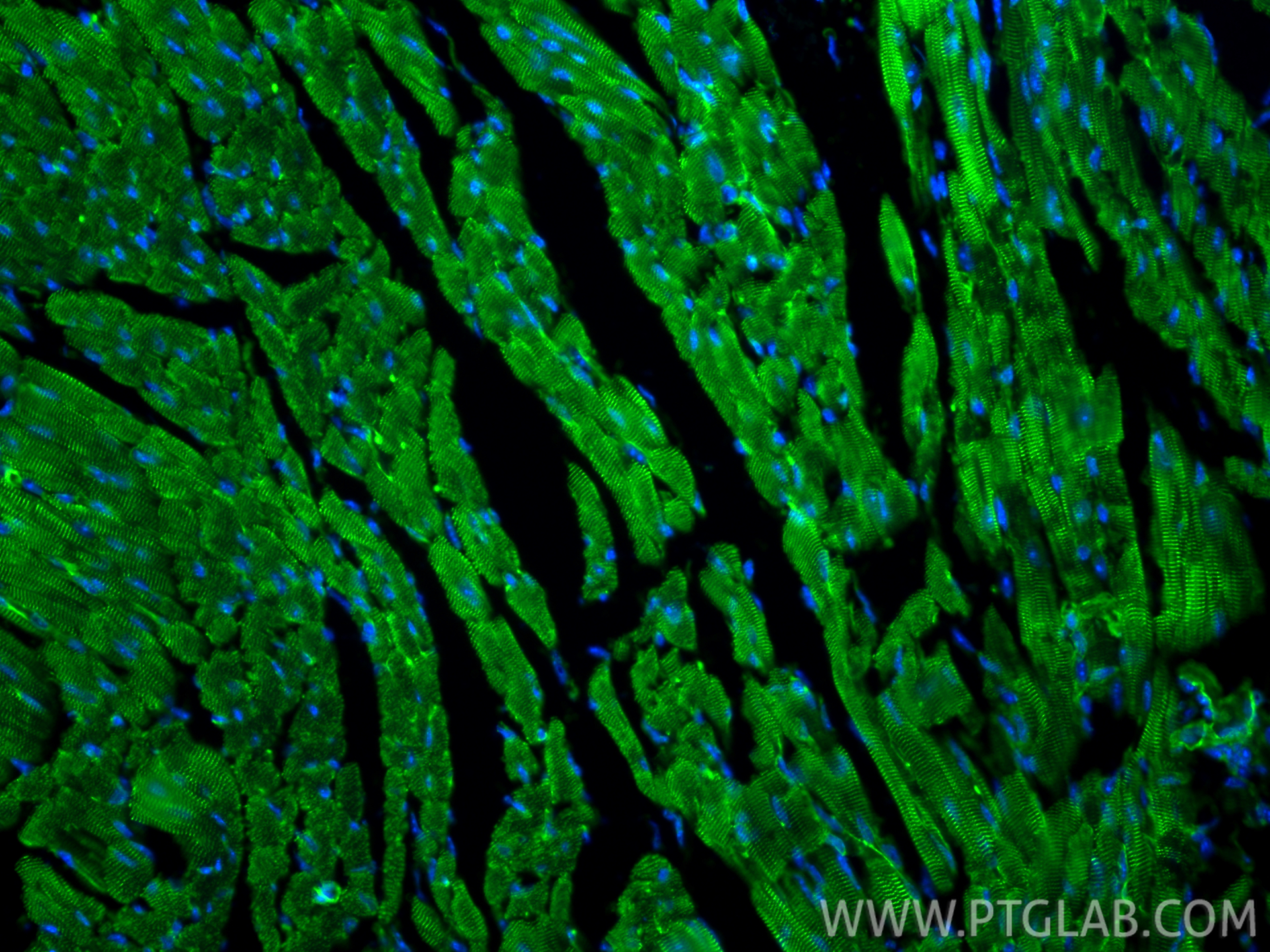 Immunofluorescence (IF) / fluorescent staining of mouse heart tissue using Alpha Actinin Polyclonal antibody (11313-2-AP)