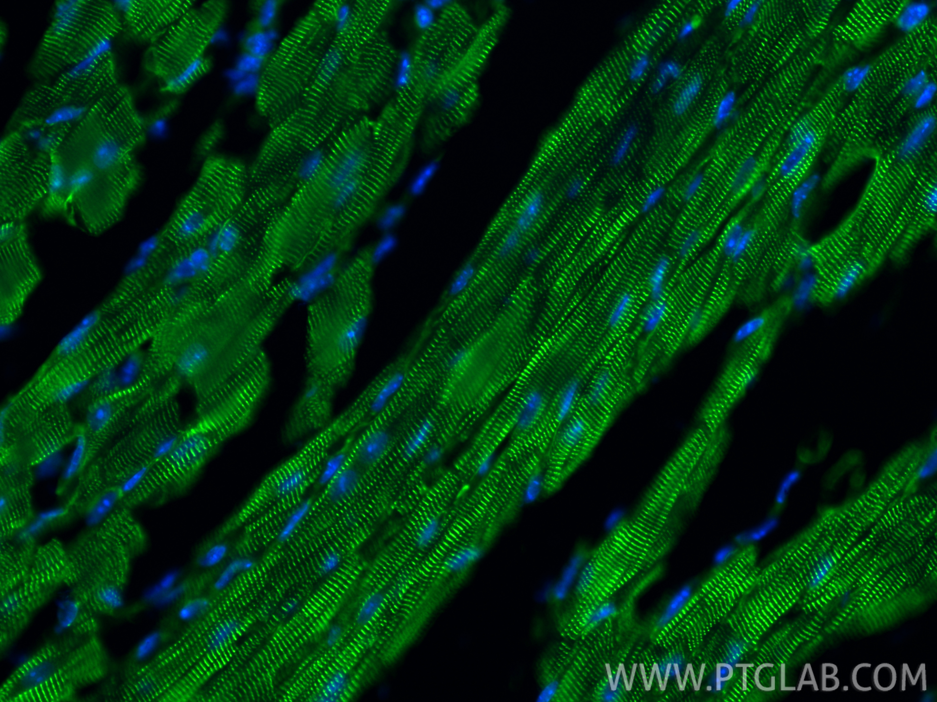 Immunofluorescence (IF) / fluorescent staining of mouse heart tissue using Alpha Actinin Polyclonal antibody (11313-2-AP)