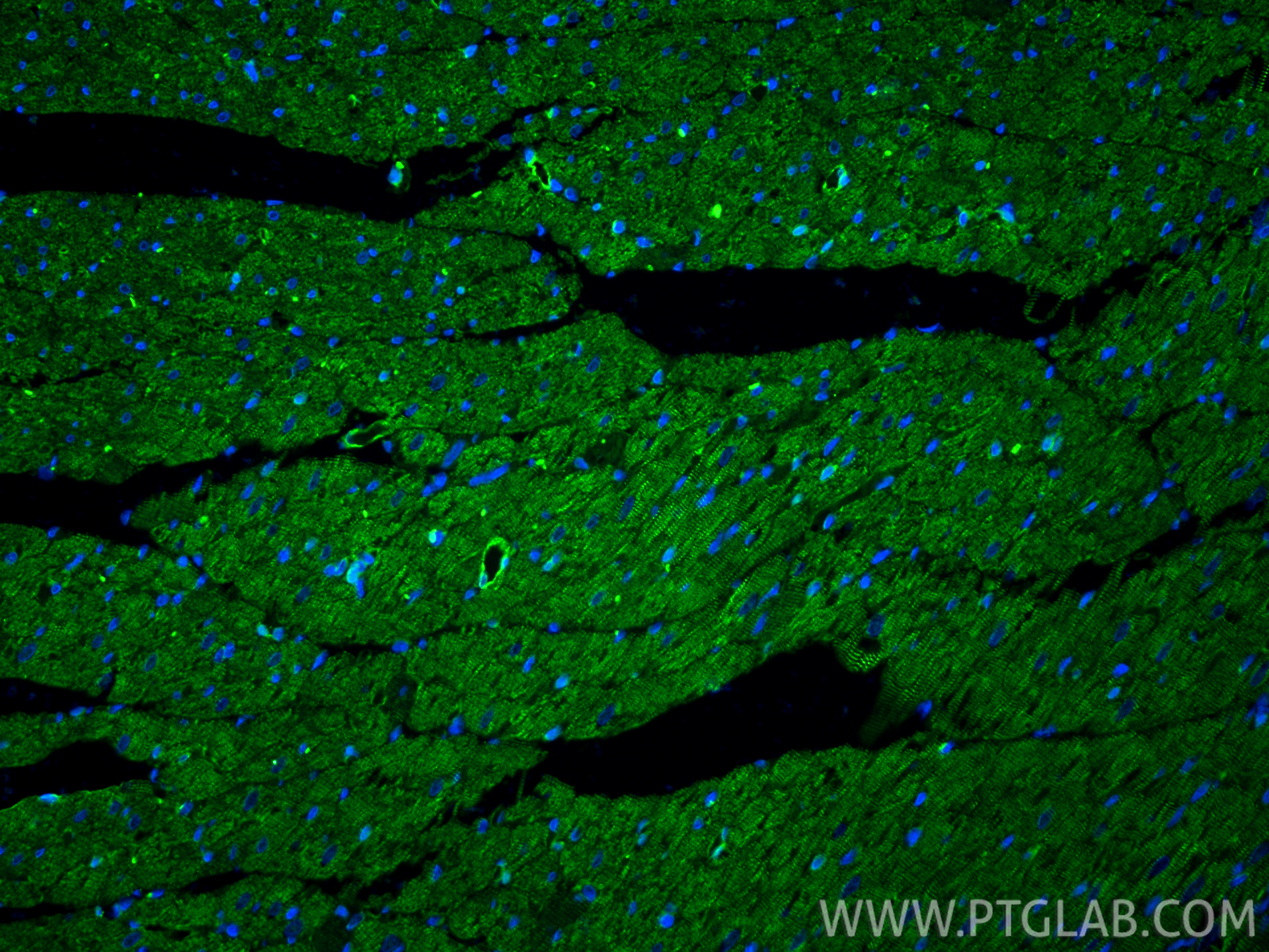Immunofluorescence (IF) / fluorescent staining of rat heart tissue using Alpha Actinin Polyclonal antibody (11313-2-AP)