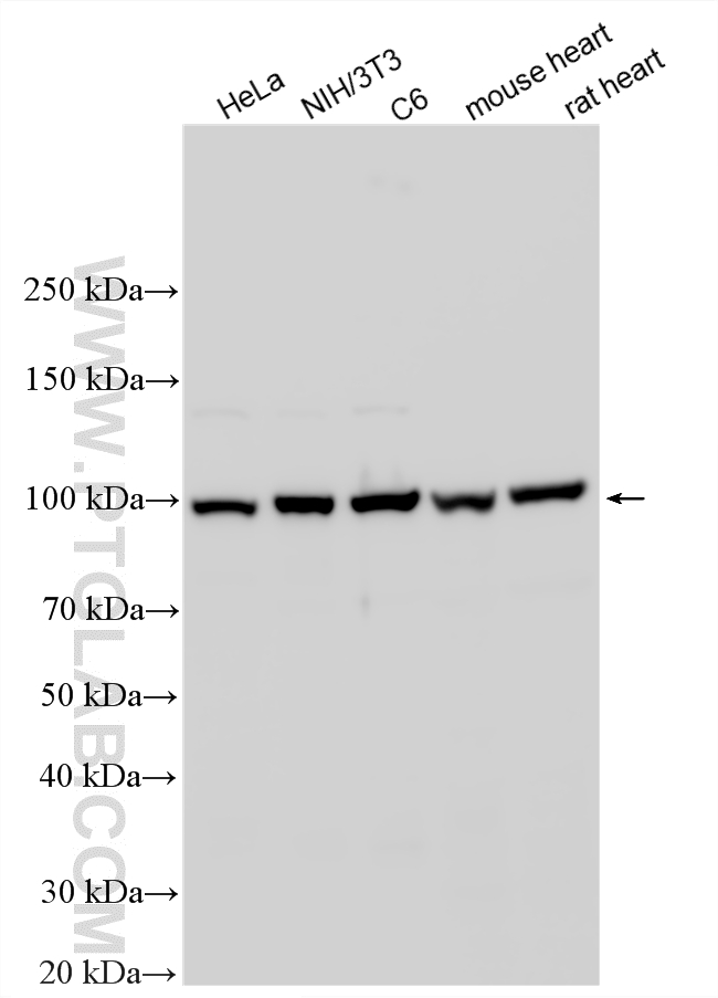 Western Blot (WB) analysis of various lysates using Alpha Actinin Polyclonal antibody (11313-2-AP)