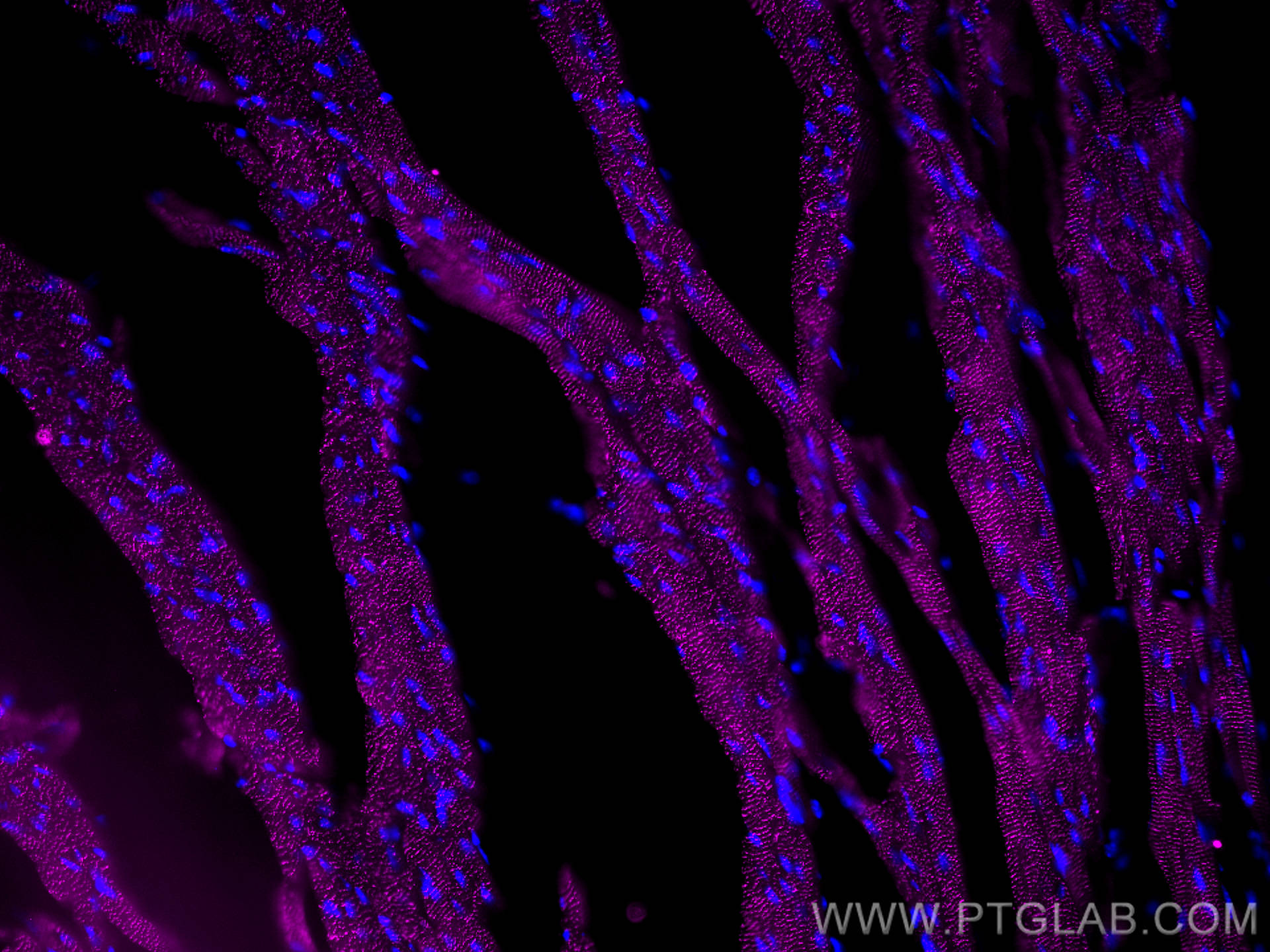 Immunofluorescence (IF) / fluorescent staining of mouse heart tissue using ACTN2 Polyclonal antibody (14221-1-AP)