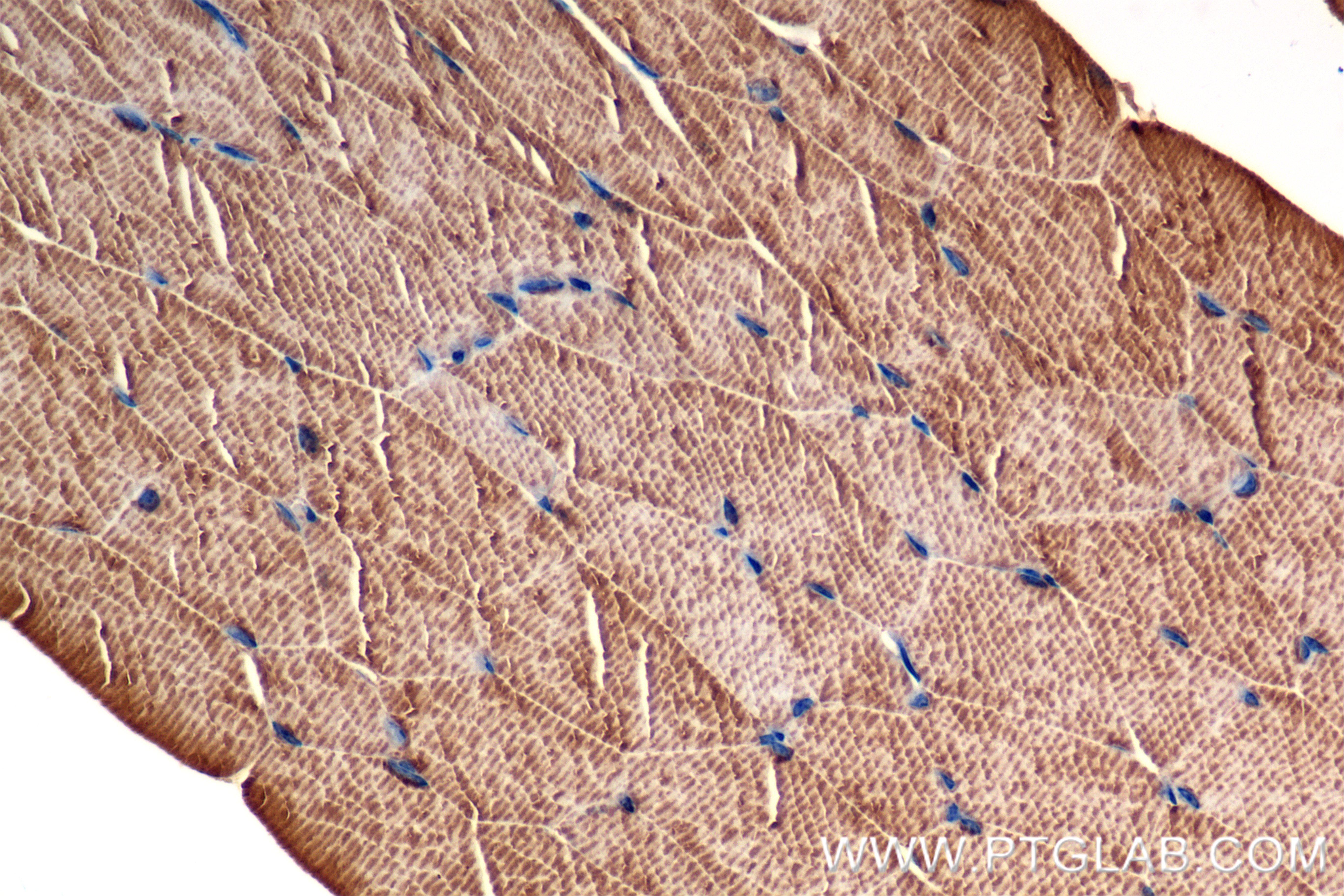 Immunohistochemistry (IHC) staining of mouse skeletal muscle tissue using ACTN2 Recombinant antibody (85857-4-RR)