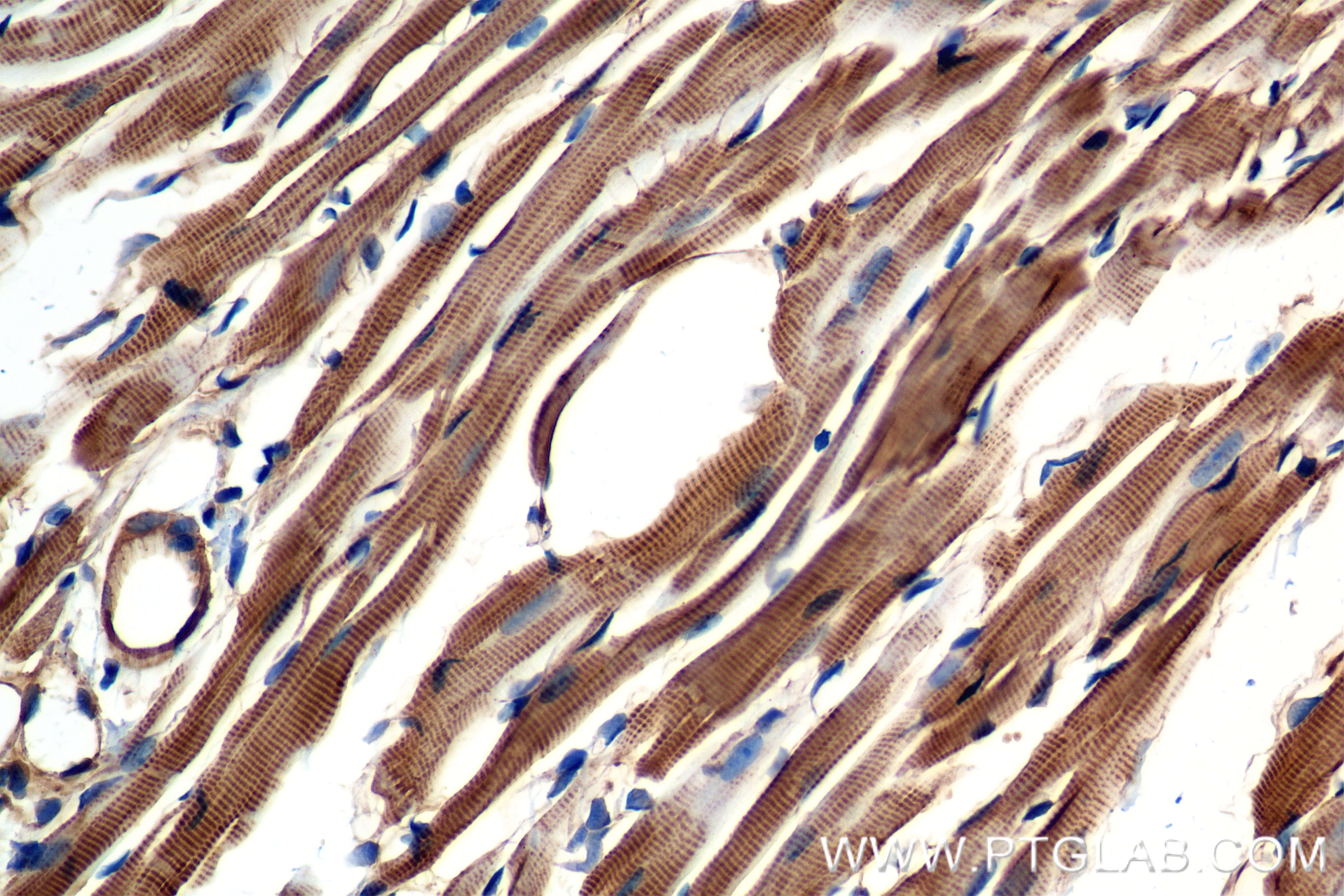 Immunohistochemistry (IHC) staining of mouse heart tissue using ACTN2 Recombinant antibody (85857-4-RR)