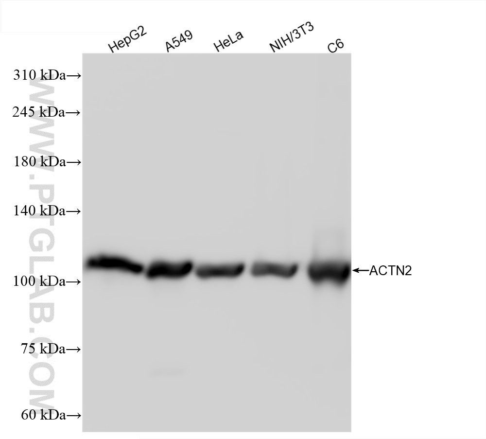 Western Blot (WB) analysis of various lysates using ACTN2 Recombinant antibody (85857-4-RR)