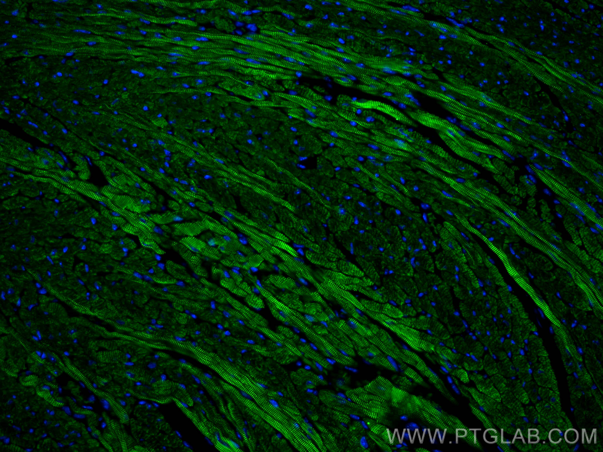 Immunofluorescence (IF) / fluorescent staining of mouse heart tissue using CoraLite® Plus 488-conjugated ACTN2 Polyclonal ant (CL488-14221)