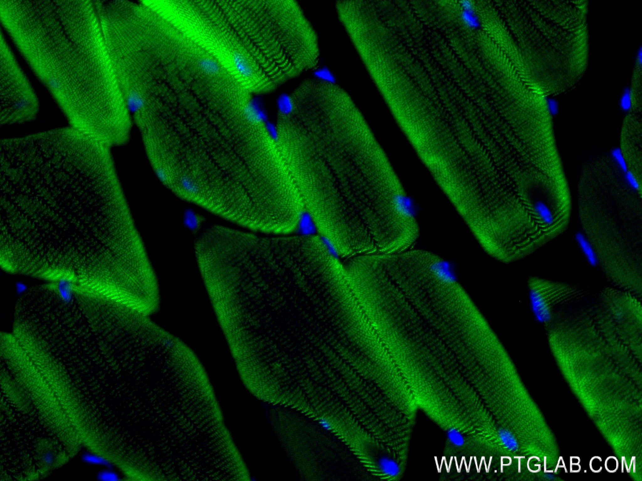 Immunofluorescence (IF) / fluorescent staining of mouse skeletal muscle tissue using ACTN3 Recombinant antibody (84356-1-RR)