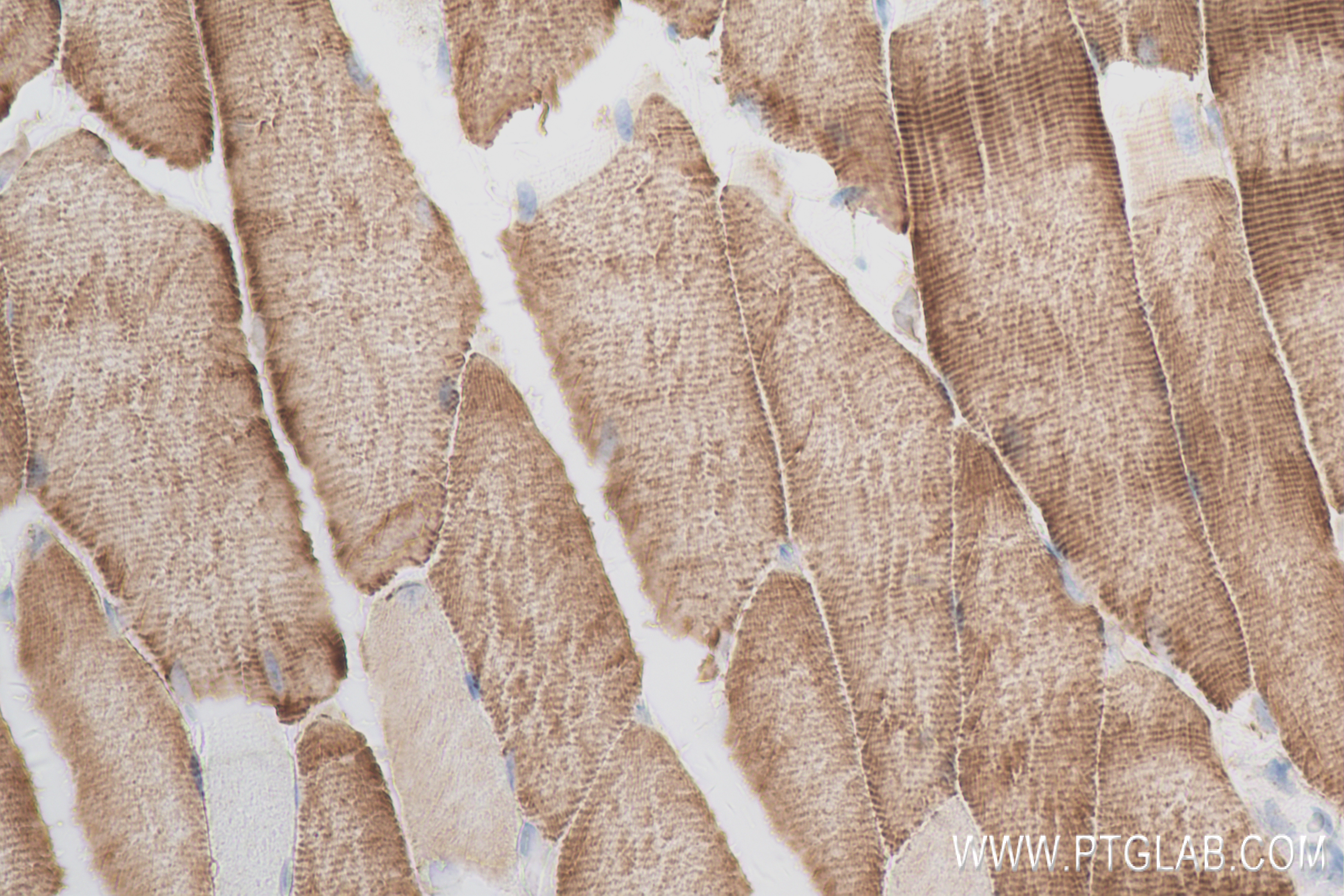 Immunohistochemistry (IHC) staining of mouse skeletal muscle tissue using ACTN3 Recombinant antibody (84356-1-RR)