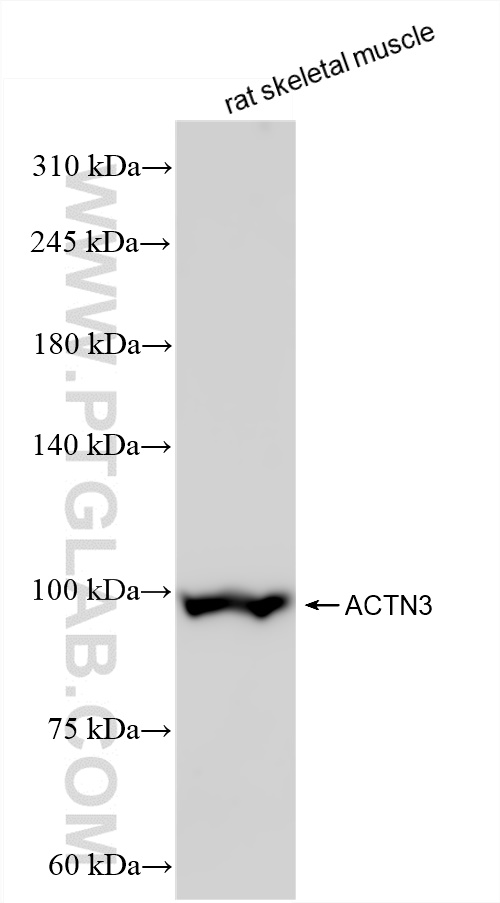 Western Blot (WB) analysis of rat skeletal muscle tissue using ACTN3 Recombinant antibody (84356-1-RR)