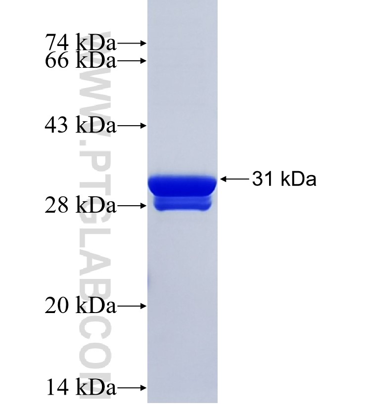 ACTN3 fusion protein Ag36709 SDS-PAGE