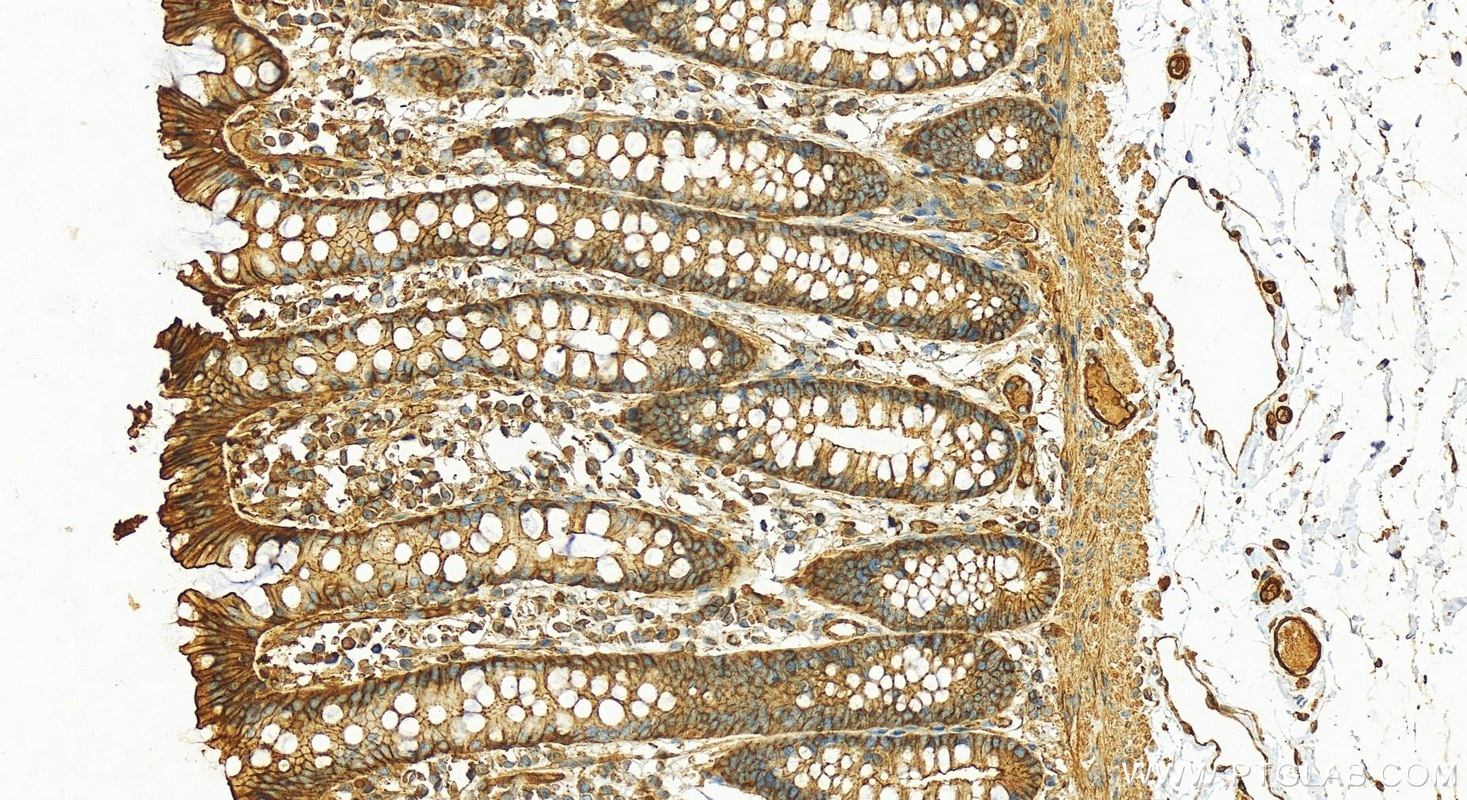 Immunohistochemistry (IHC) staining of human colon tissue using ACTN4 Polyclonal antibody (19096-1-AP)