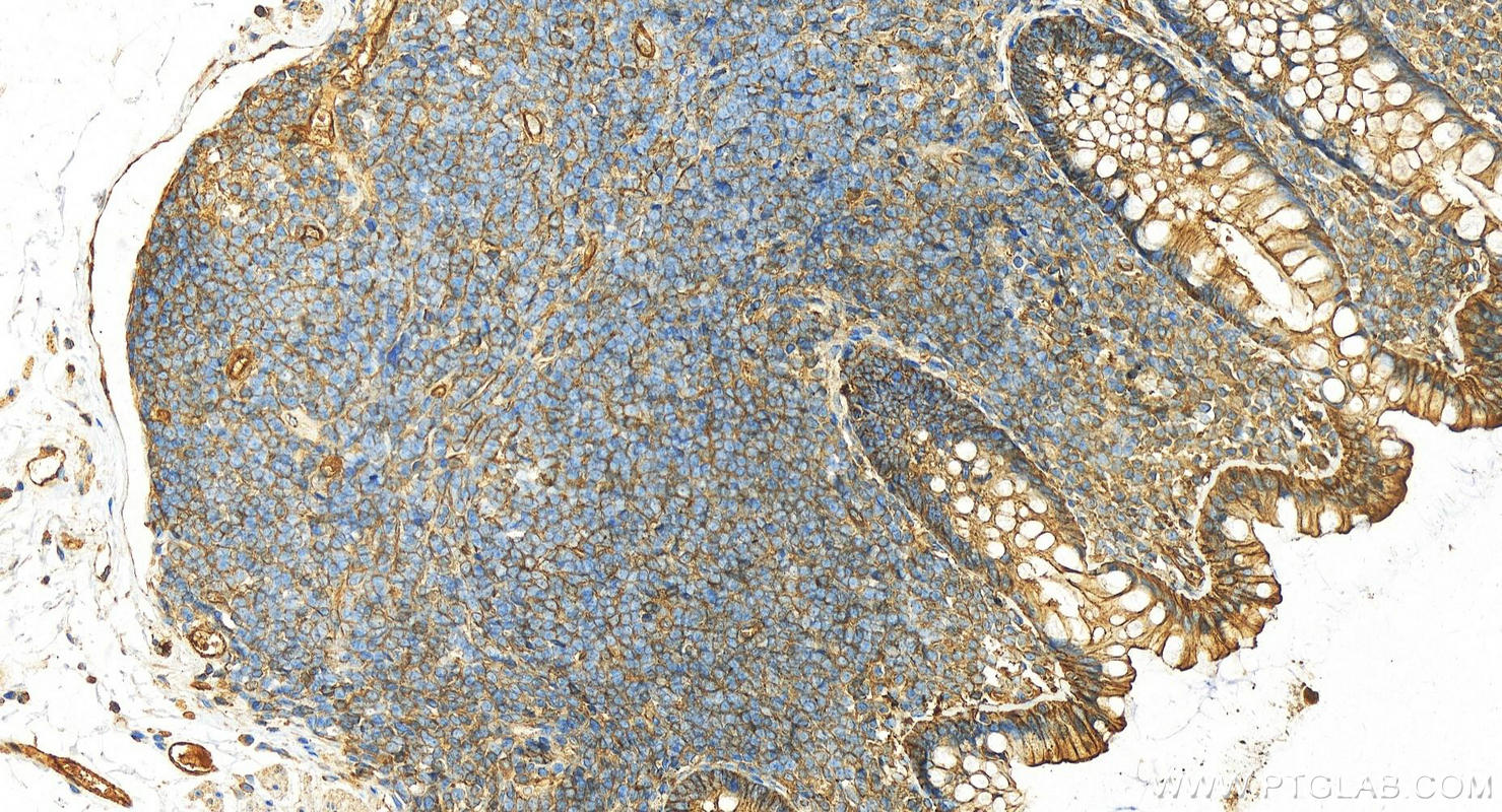 Immunohistochemistry (IHC) staining of human normal colon using ACTN4 Polyclonal antibody (19096-1-AP)