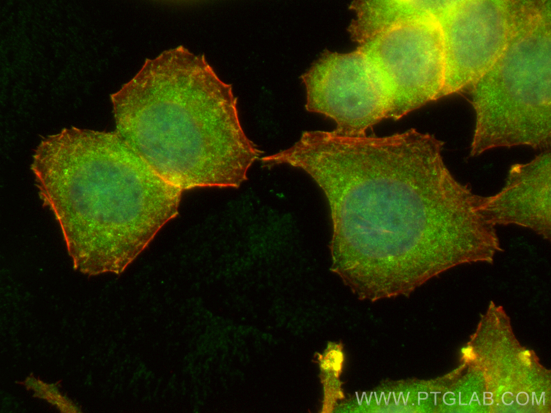 Immunofluorescence (IF) / fluorescent staining of MCF-7 cells using ACTN4 Polyclonal antibody (19096-1-AP)