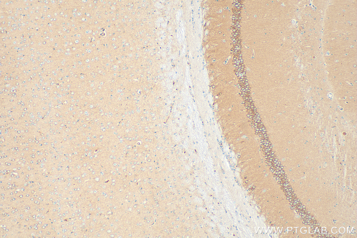 Immunohistochemistry (IHC) staining of mouse brain tissue using ARP2 Polyclonal antibody (10922-1-AP)