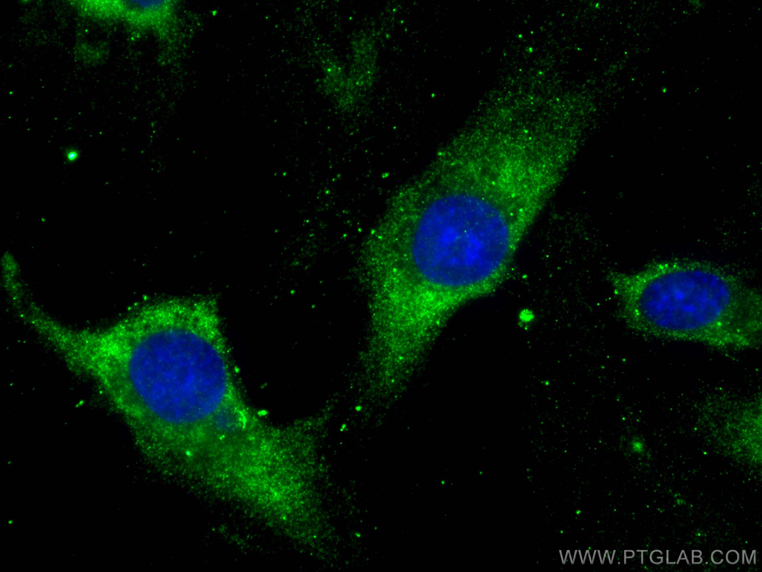 Immunofluorescence (IF) / fluorescent staining of HUVEC cells using ARP3/ARP3B Monoclonal antibody (68439-1-Ig)