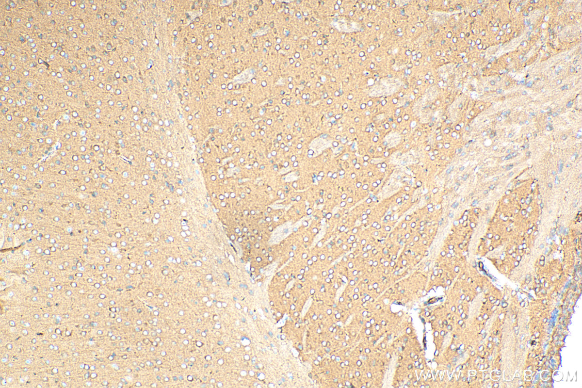 Immunohistochemistry (IHC) staining of mouse brain tissue using ACTR3B Monoclonal antibody (68037-1-Ig)