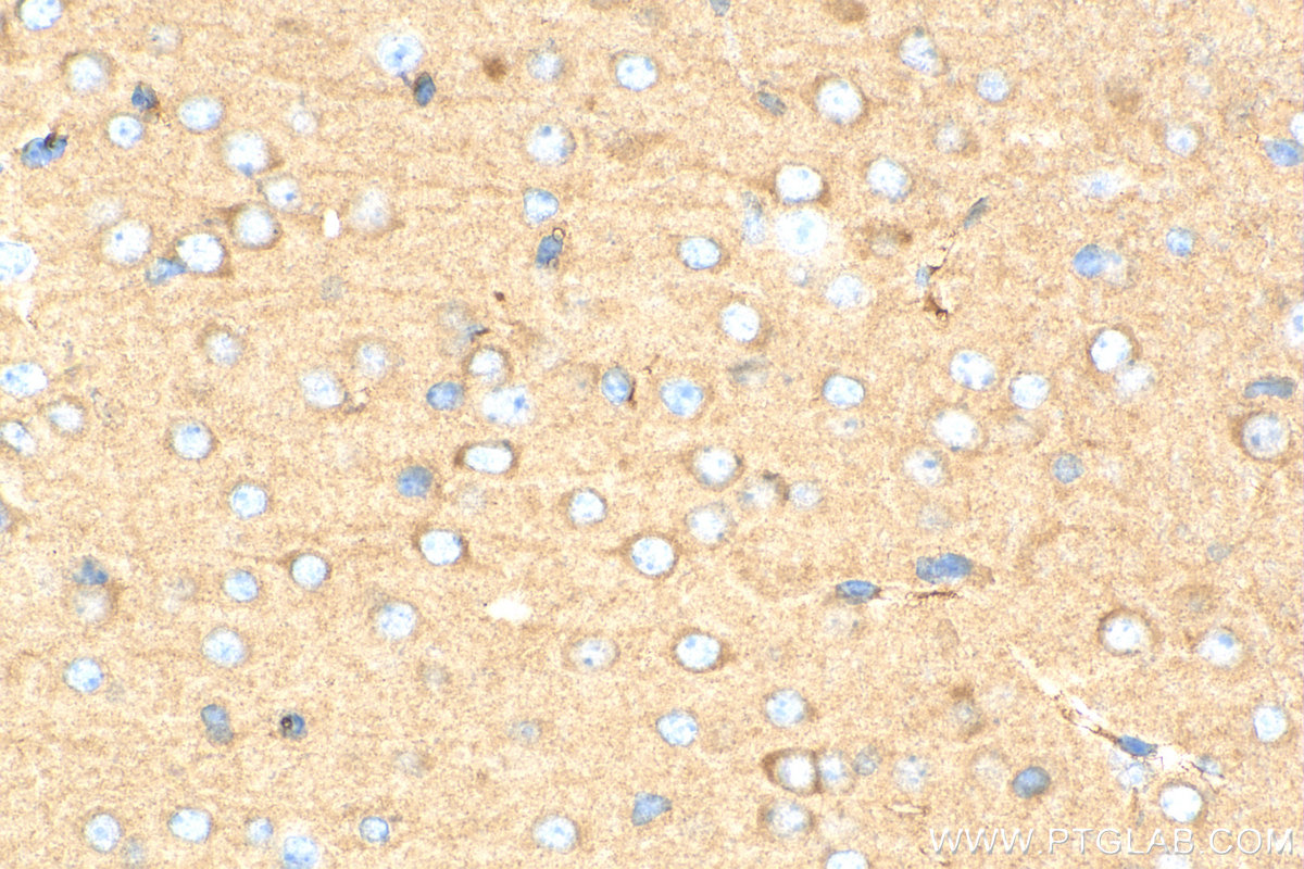Immunohistochemistry (IHC) staining of mouse brain tissue using ACTR3B Monoclonal antibody (68037-1-Ig)