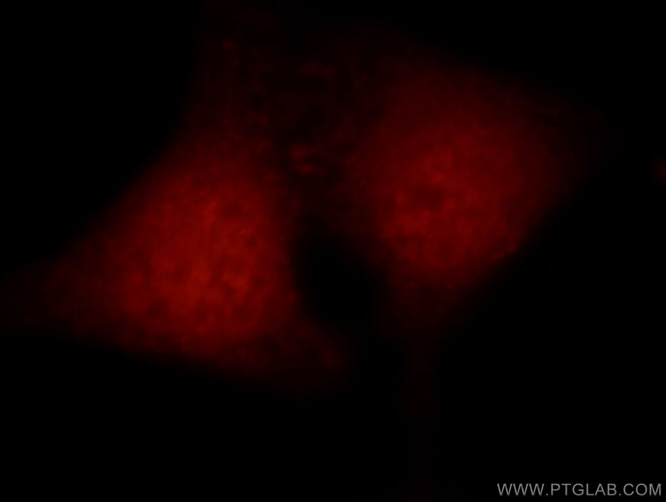 Immunofluorescence (IF) / fluorescent staining of HepG2 cells using Arp5/ACTR5 Polyclonal antibody (21505-1-AP)