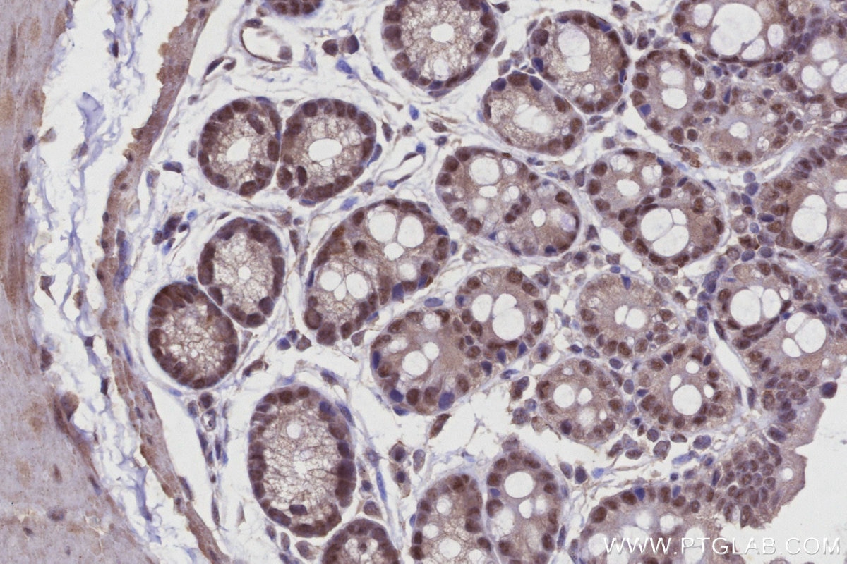 Immunohistochemistry (IHC) staining of mouse colon tissue using Arp5/ACTR5 Polyclonal antibody (21505-1-AP)