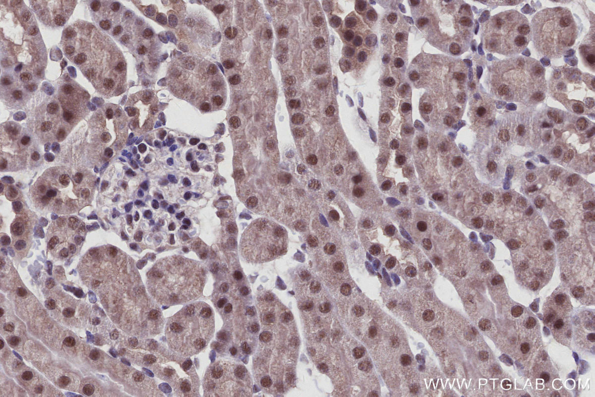 Immunohistochemistry (IHC) staining of mouse kidney tissue using Arp5/ACTR5 Polyclonal antibody (21505-1-AP)