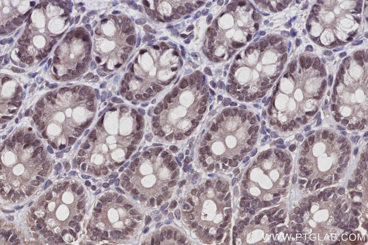 Immunohistochemistry (IHC) staining of rat colon tissue using Arp5/ACTR5 Polyclonal antibody (21505-1-AP)