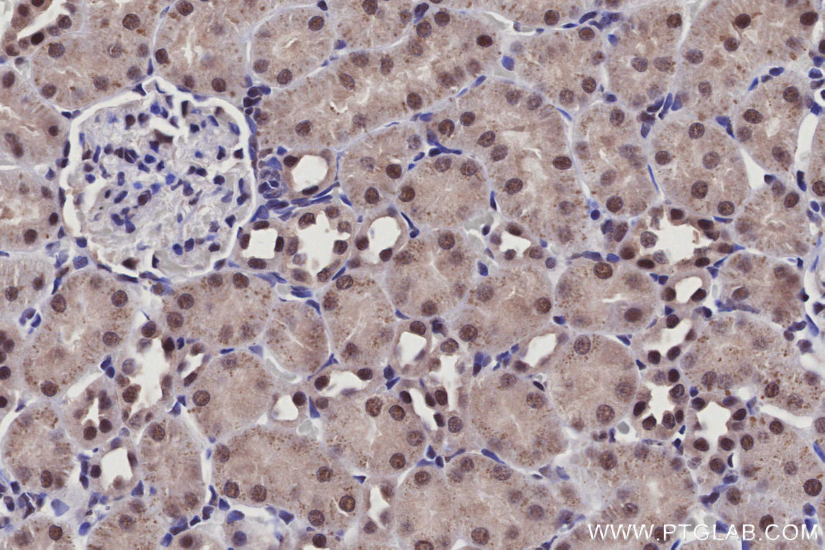 Immunohistochemistry (IHC) staining of rat kidney tissue using Arp5/ACTR5 Polyclonal antibody (21505-1-AP)
