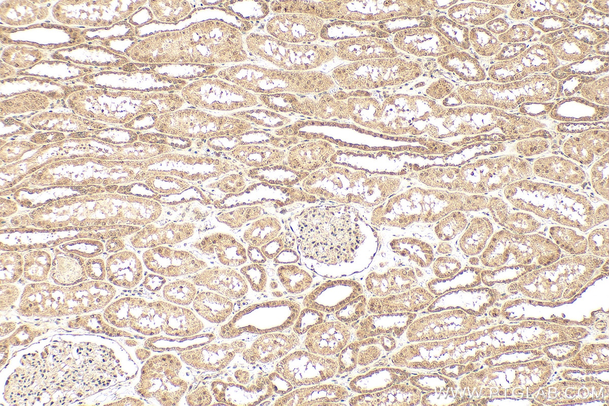 Immunohistochemistry (IHC) staining of human kidney tissue using Arp5/ACTR5 Polyclonal antibody (21505-1-AP)