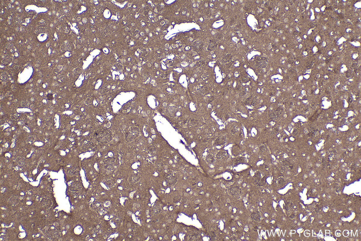 Immunohistochemistry (IHC) staining of mouse brain tissue using ACVR1B Recombinant antibody (83026-6-RR)