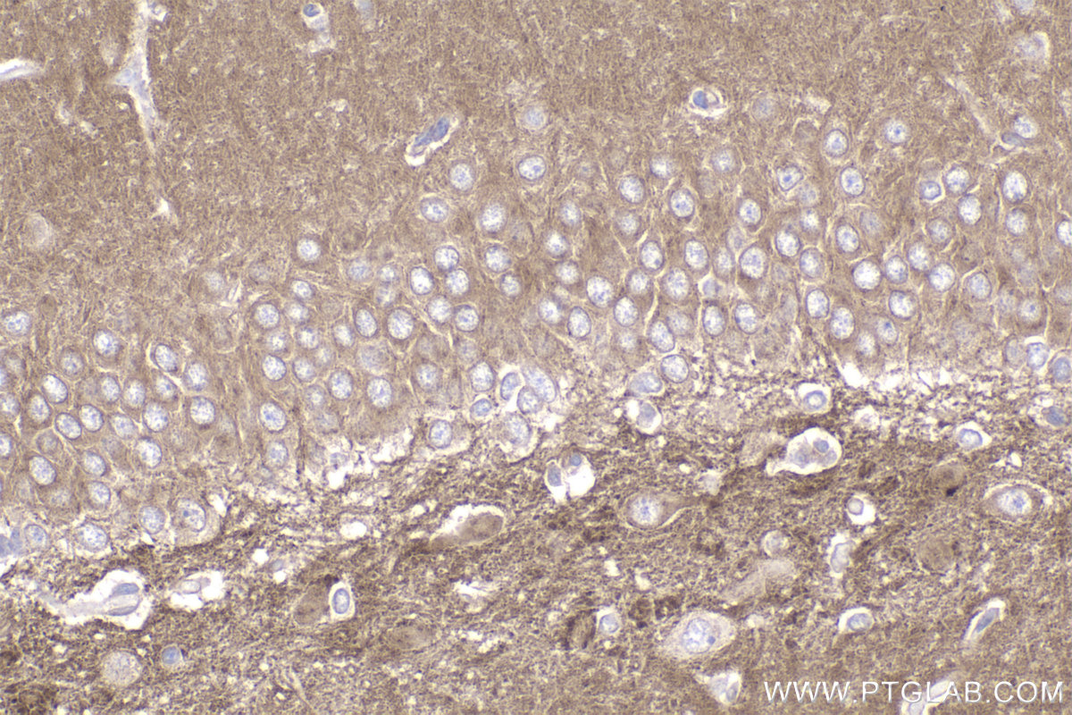 Immunohistochemistry (IHC) staining of rat brain tissue using ACVR1B Recombinant antibody (83026-6-RR)