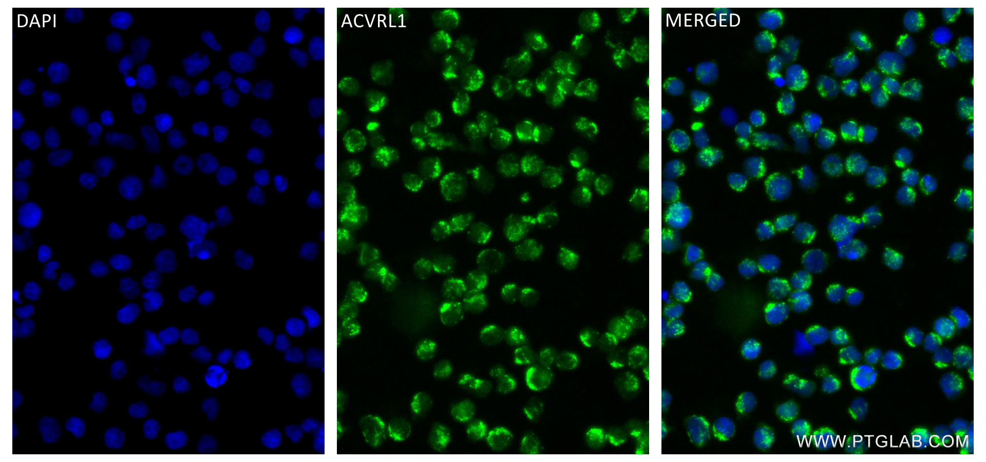 Immunofluorescence (IF) / fluorescent staining of Jurkat cells using ACVRL1 Recombinant antibody (84421-1-RR)